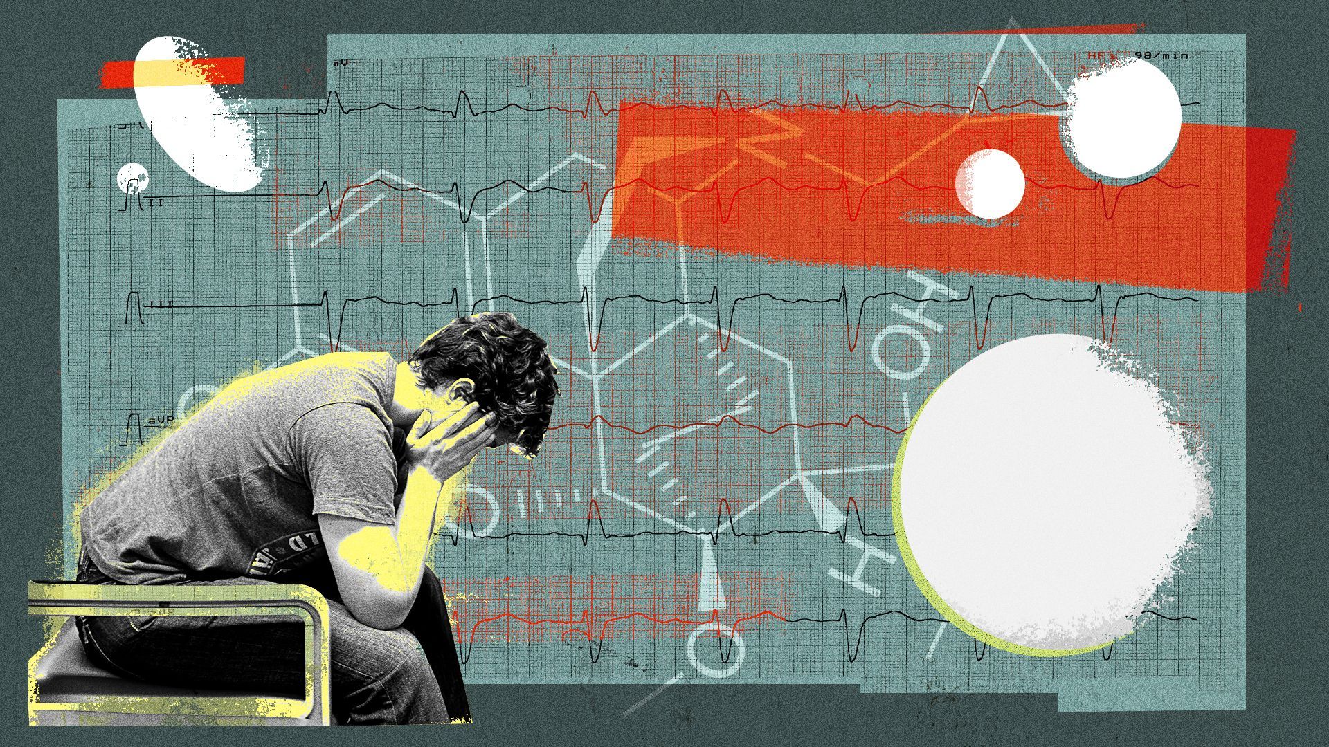 Illustration of a person holding their hand in their hands with buprenorphine's chemical structure, EKGs and abstracted pills.