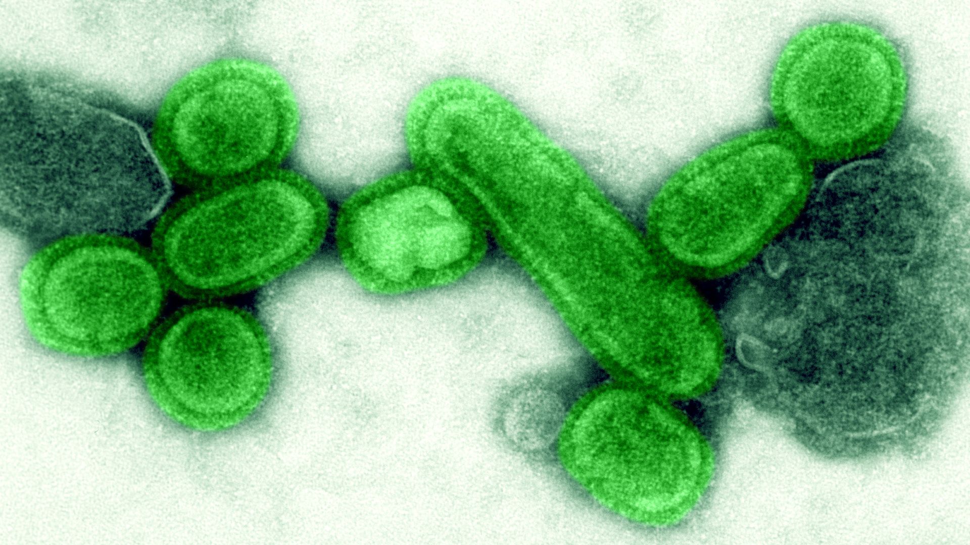Image of green H1N1 virus responsible for the deadly Spanish Flue outbreak in 1918.