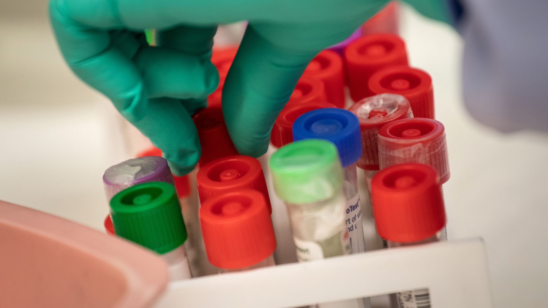 A green glove handles coronavirus test vials.