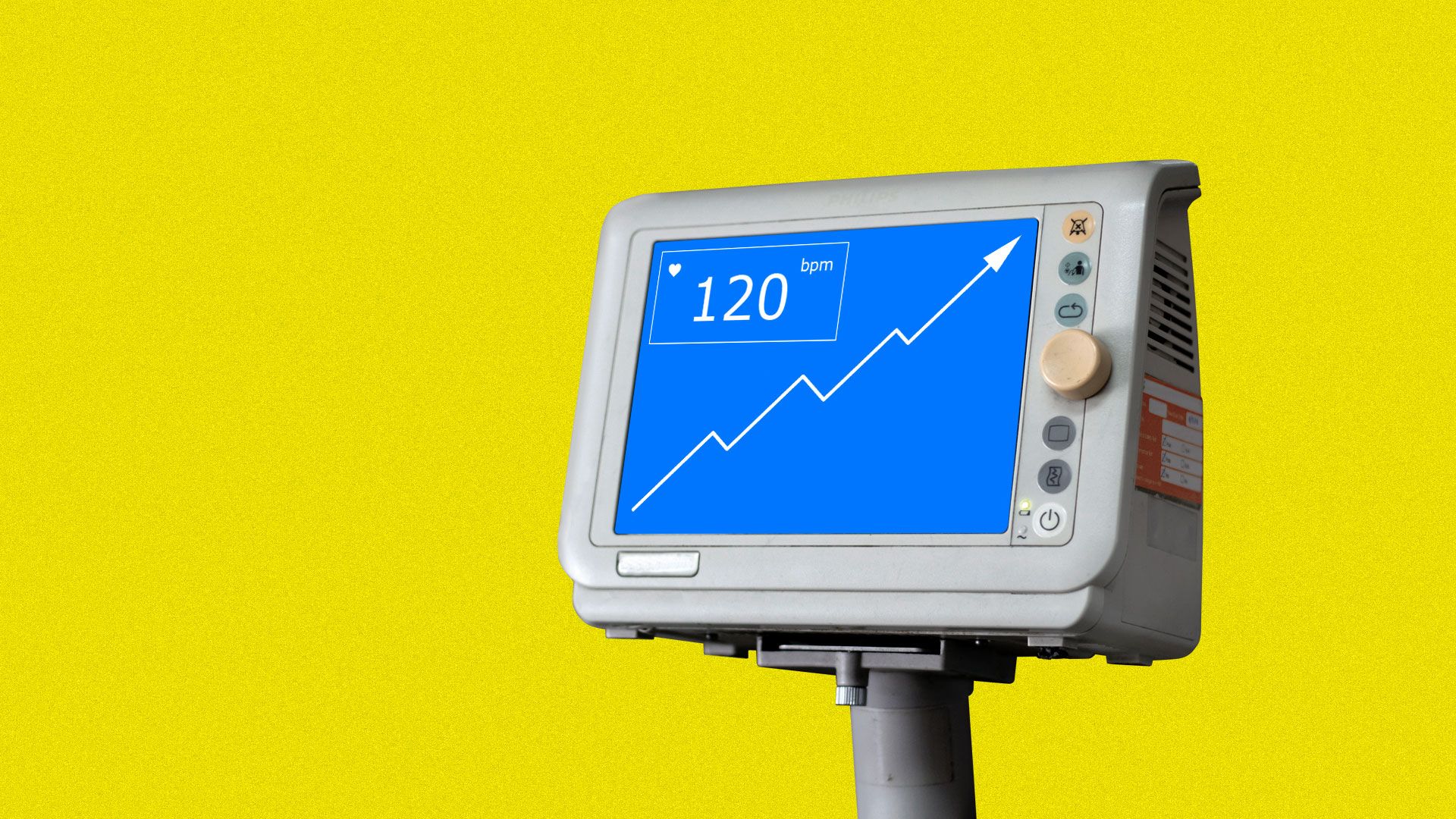 A medical vitals monitor showing a market trend line