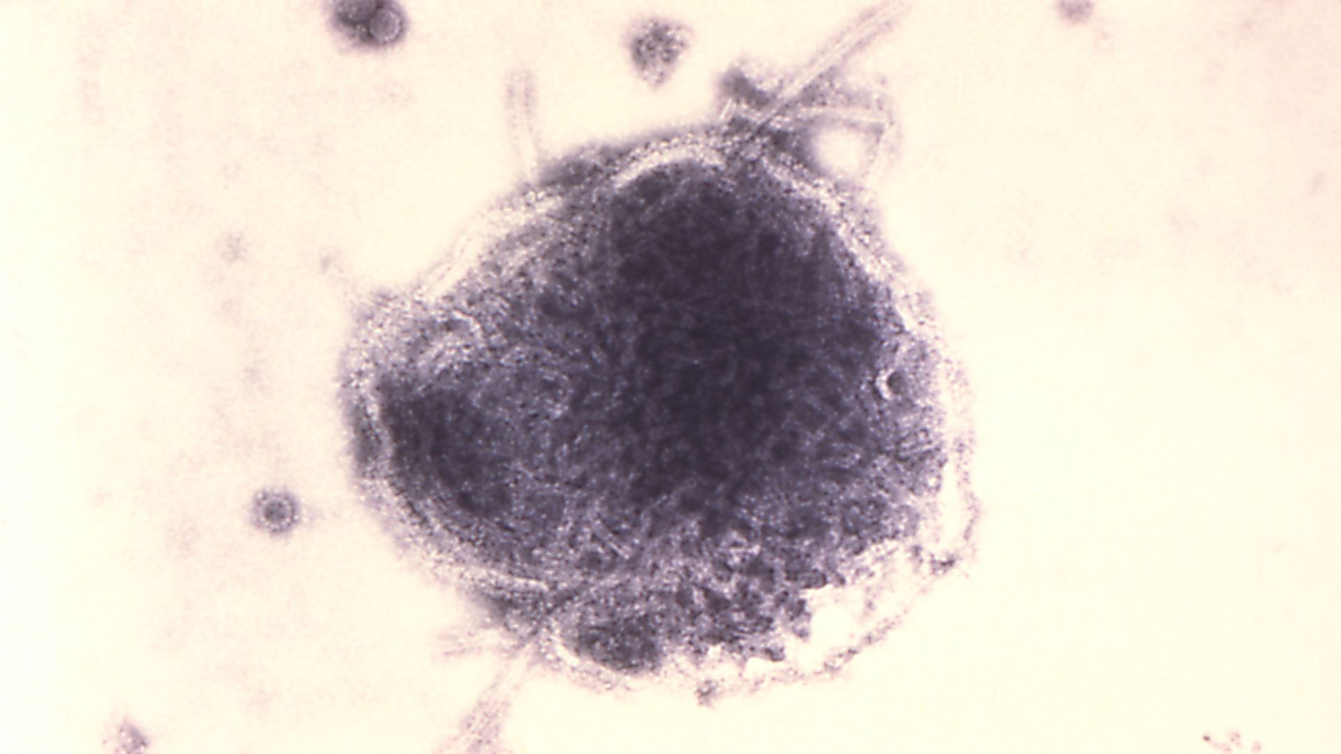 A colorized transmission electron micrograph showing measles virus and SV40 particles.