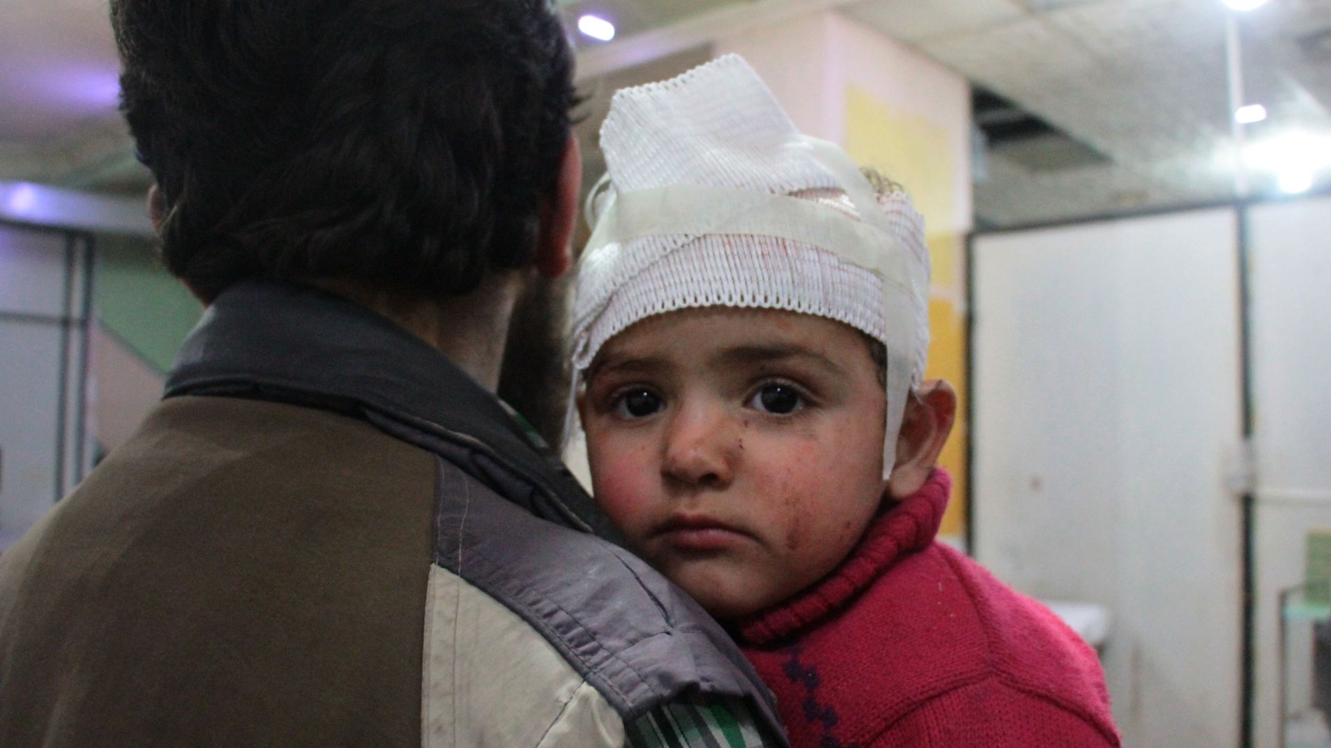 A Syrian man carries an injured child in a make-shift hospital following regime air strikes on the rebel-held besieged town of Douma in the eastern Ghouta region.