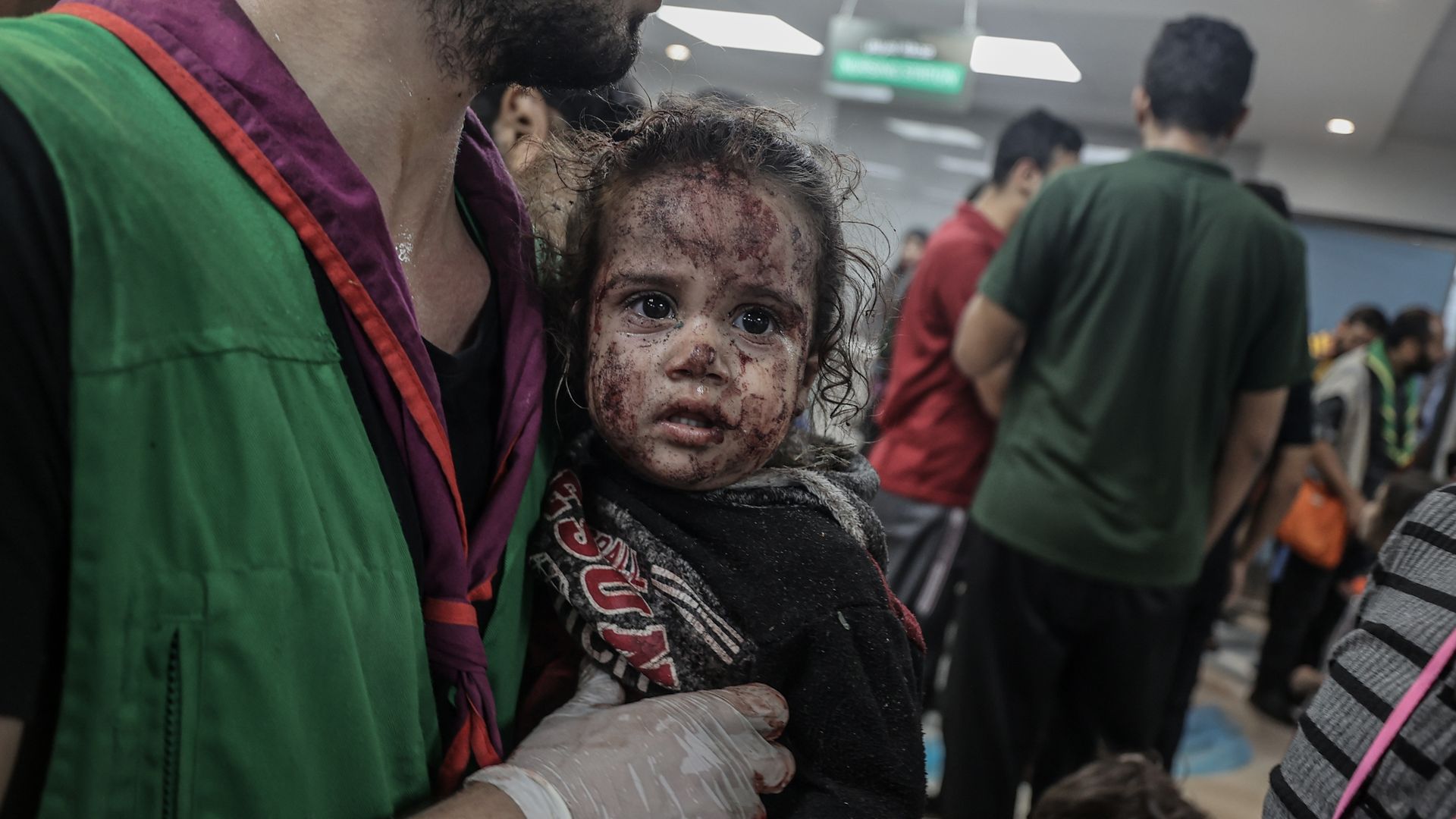 Scores of injured people are being taken to Al-Shifa Hospital following Israeli airstrike on Al-Ahli Baptist Hospital in Gaza City, Gaza on October 17, 2023