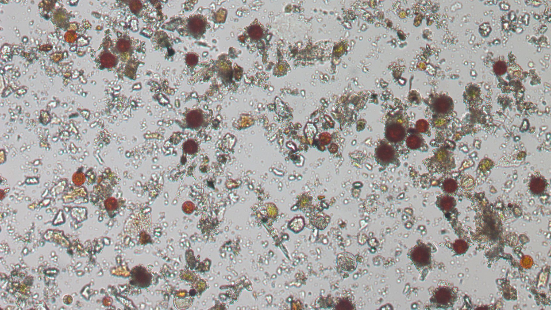 Algae in red snow.
