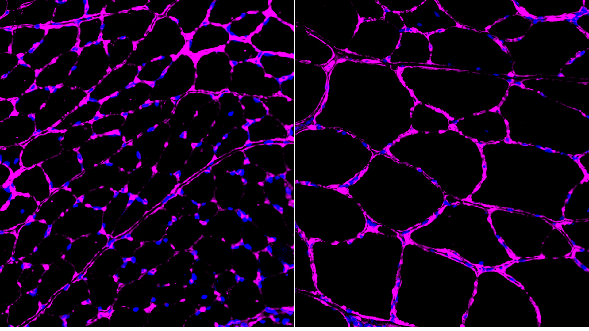 A network of activated genes in the muscles of Duchenne muscular dystrophy mice.