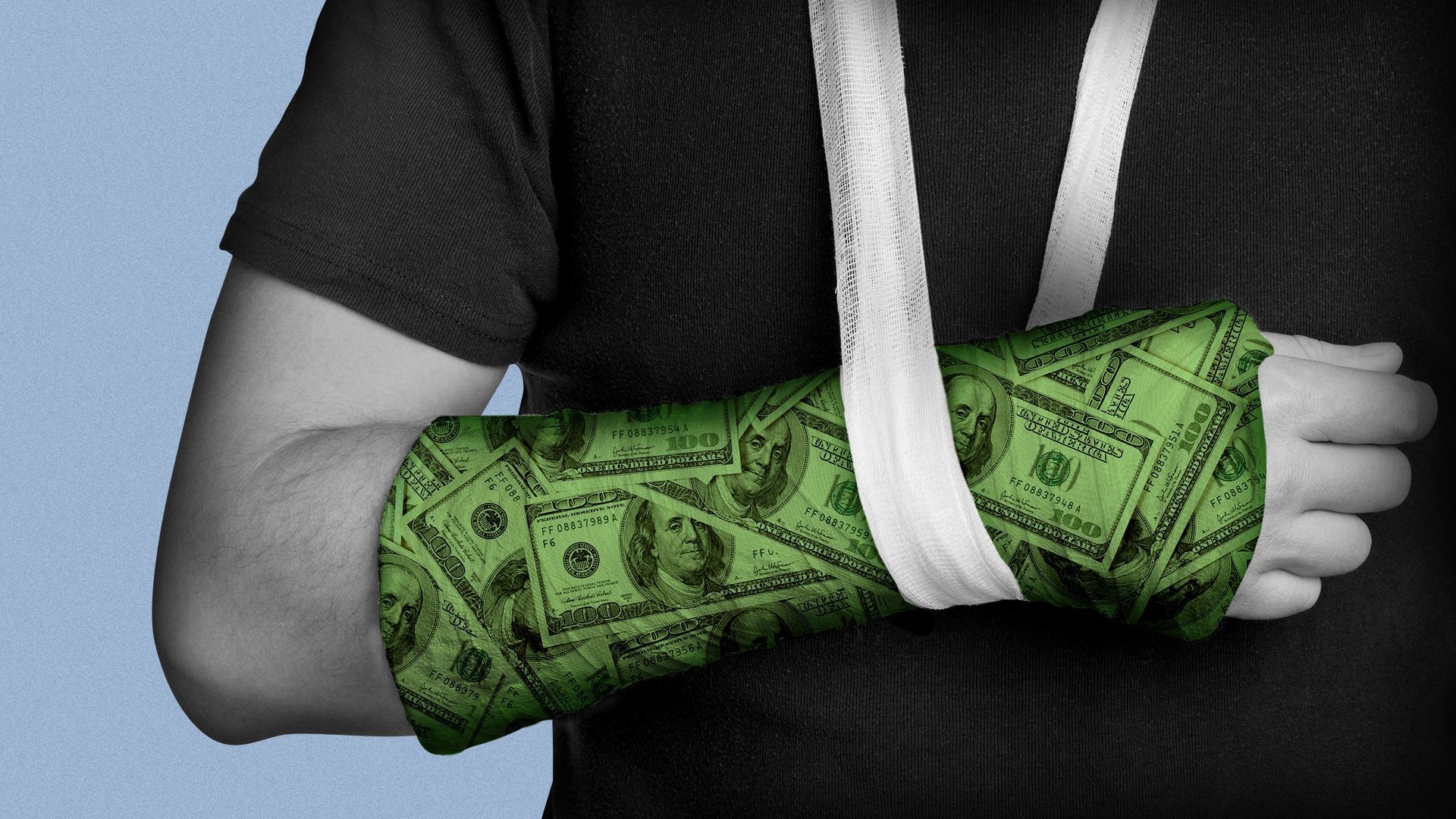 Illustration of an arm cast in a sling made out of hundred dollar bills. 