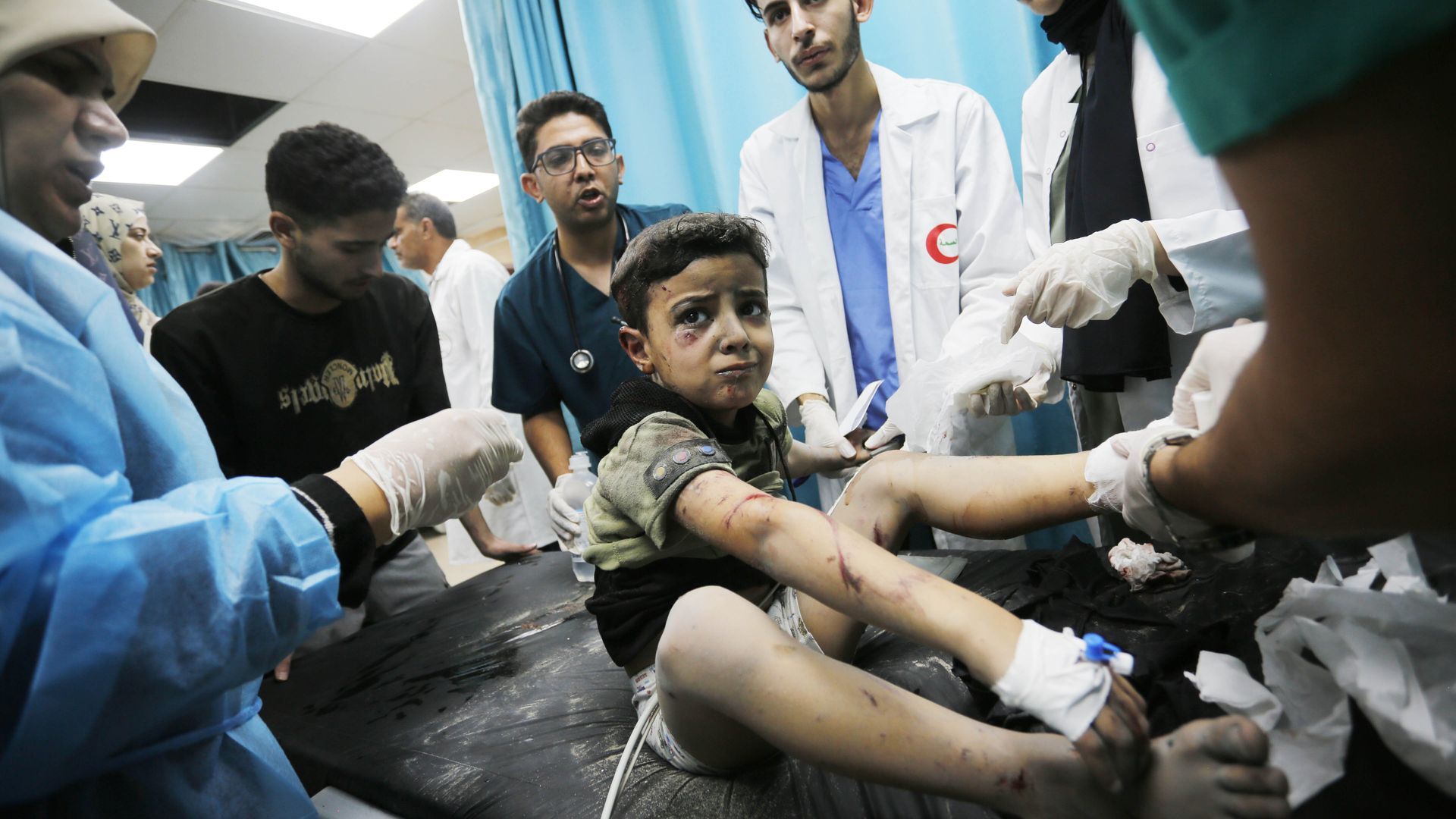A Palestinian boy injured in Israeli airstrikes receives medical treatment at the Aqsa Hospital in Deir Al-Balah, Gaza, on Oct. 15. Photo: Ashraf Amra/Anadolu via Getty Images