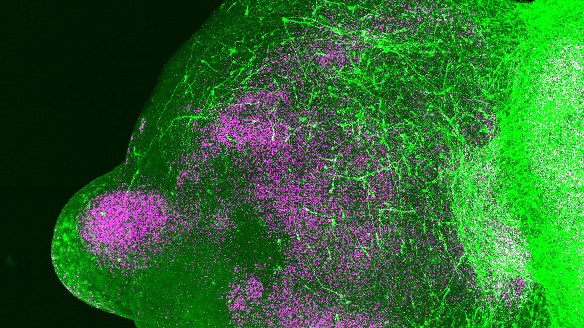 Image of neurons migrating in an assembloid