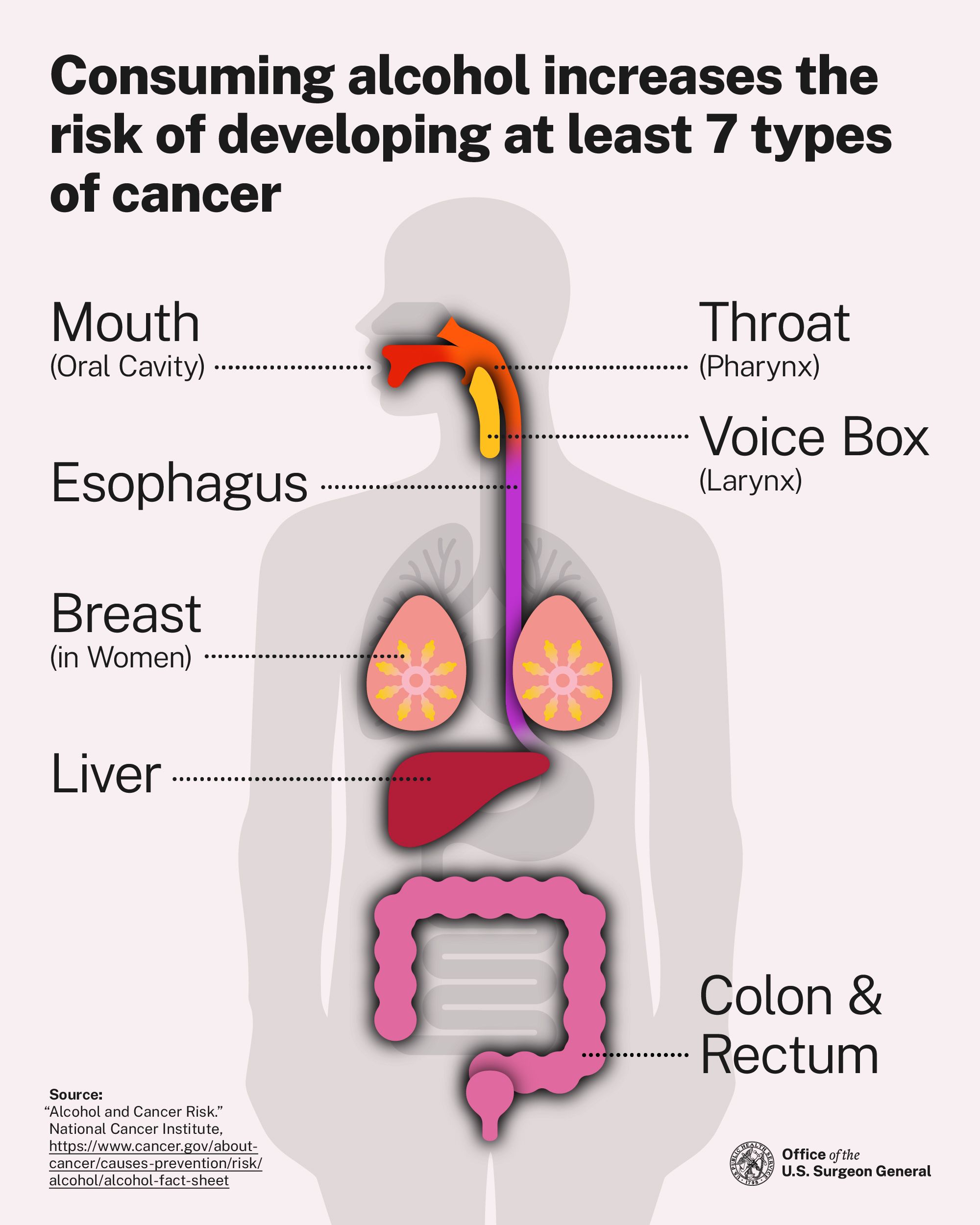 Illustration of the seven cancer risks linked to alcohol consumption.