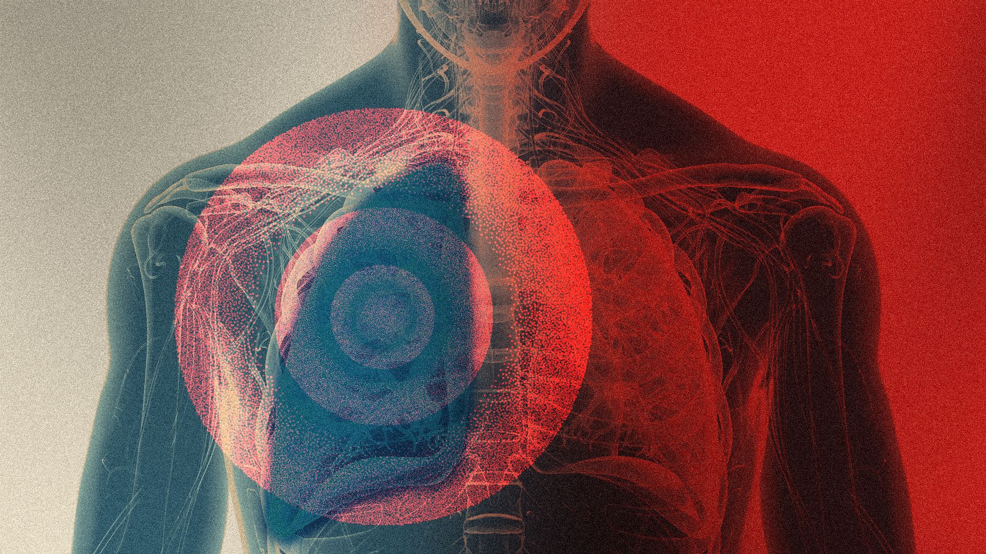 Illustration of a diagram of a human chest with radiating lines coming from one lung