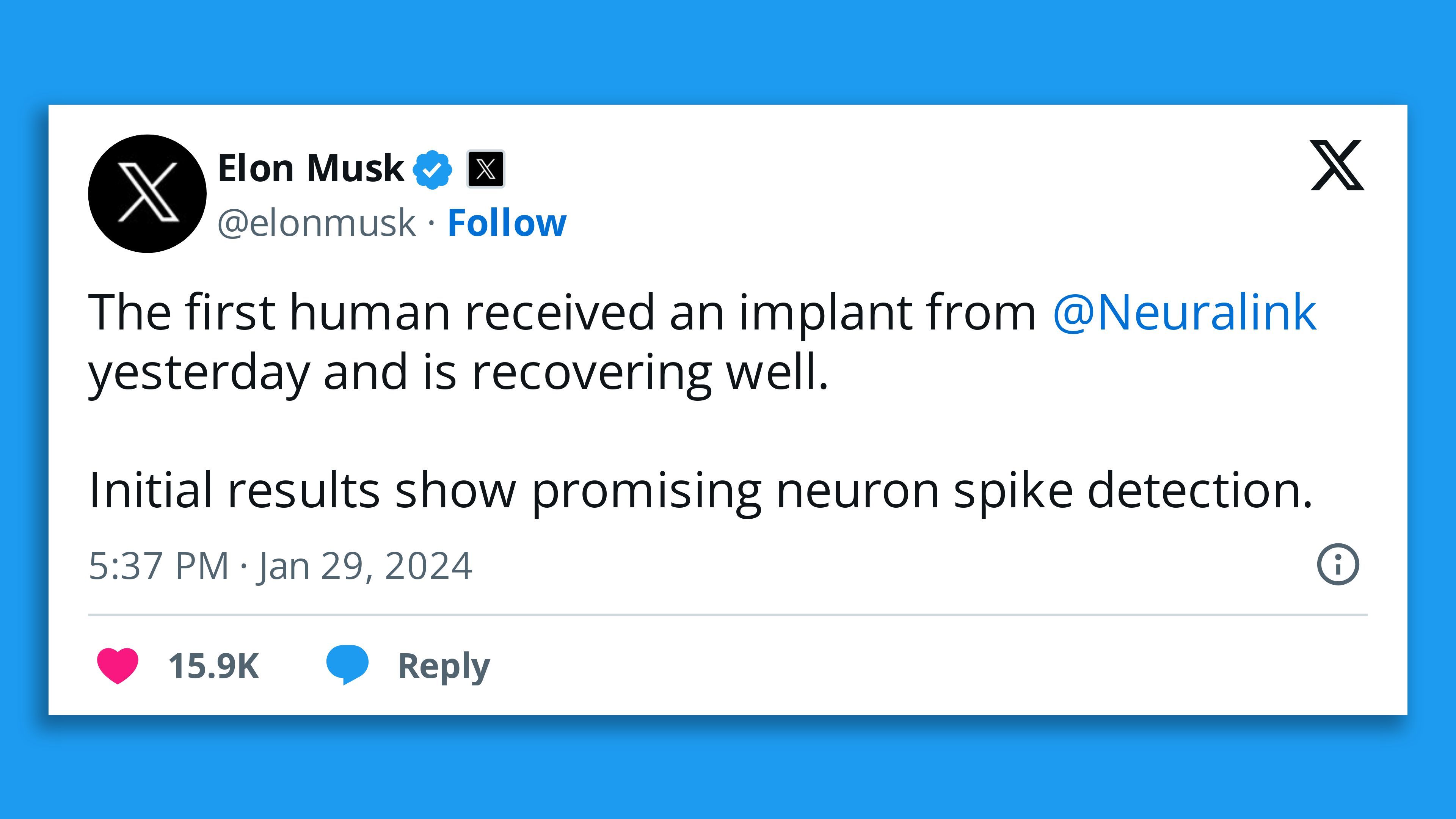 A post on X from Elon Musk that says "The first human received an implant from  @Neuralink  yesterday and is recovering well.  Initial results show promising neuron spike detection."