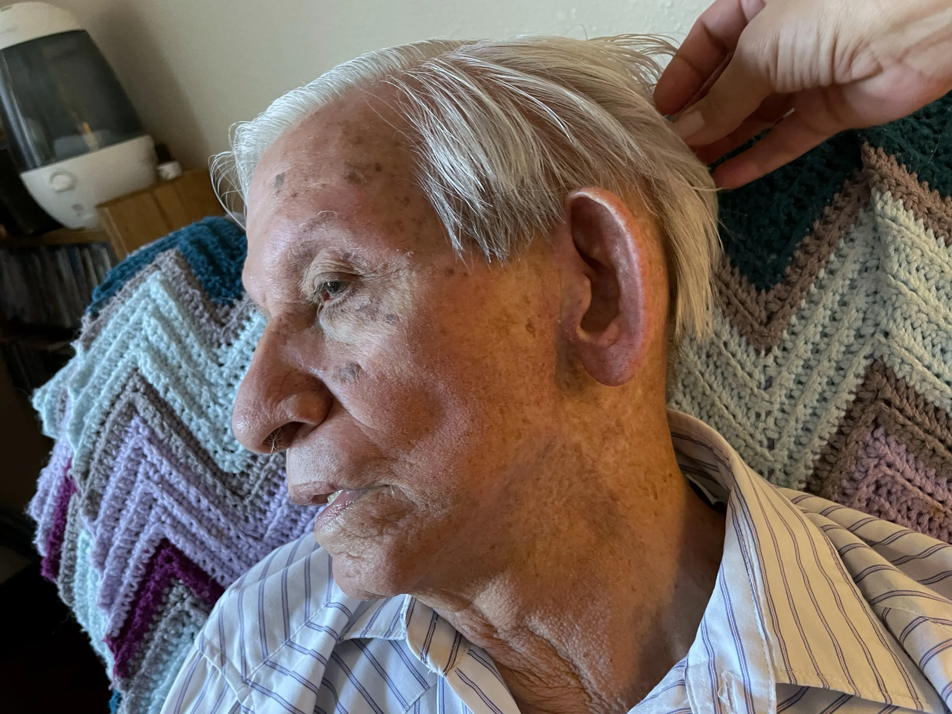 Henry Herrera, 87, shows the lack of hair on the back of his head and jaw resulting from cancer treatment years after he witnessed the Trinity Test. 
