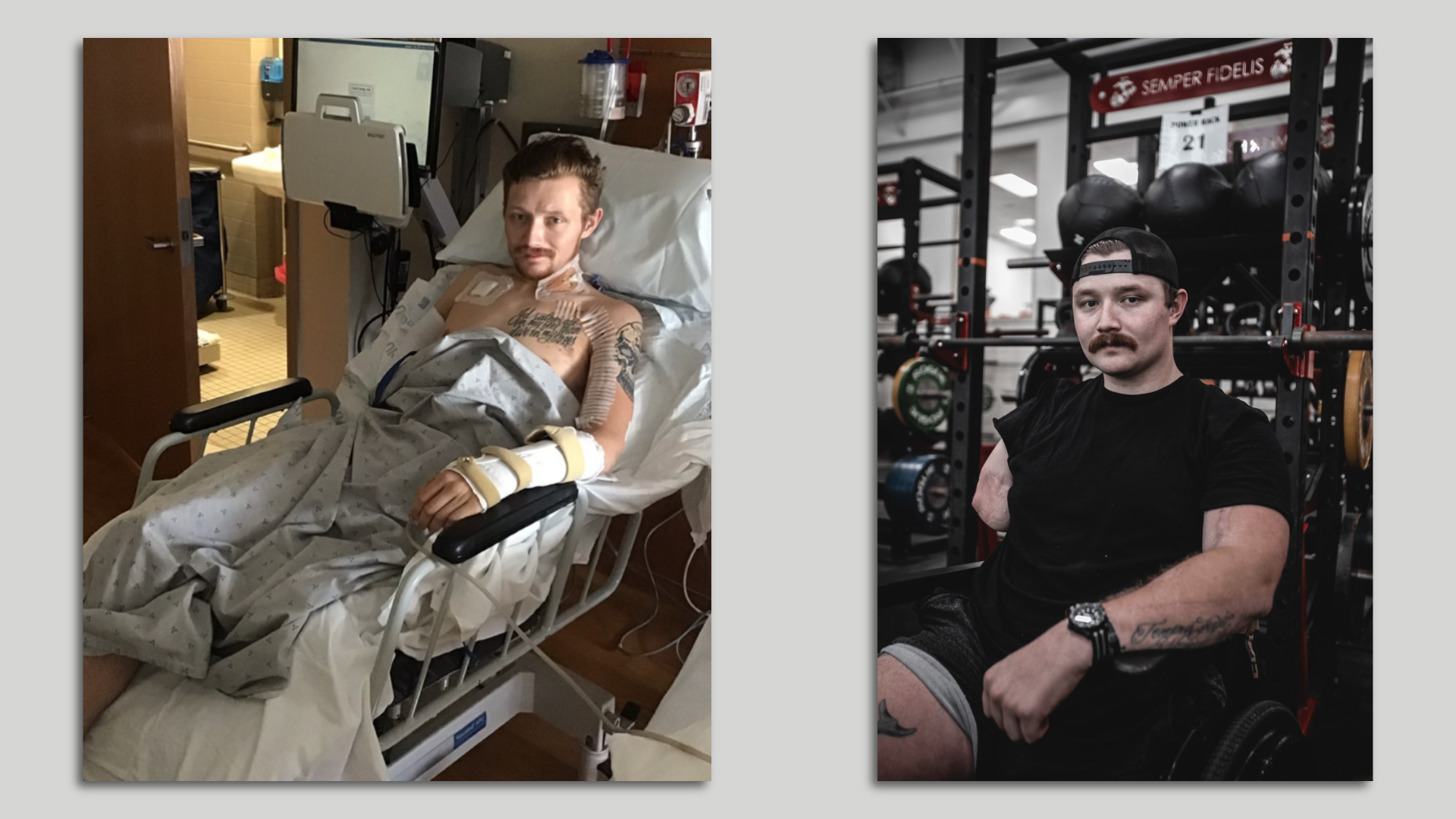 A before and after of Andrews, in a hospital bed after being wounded at war (left) and recovered in a gym wearing a black t-shirt and hat. 