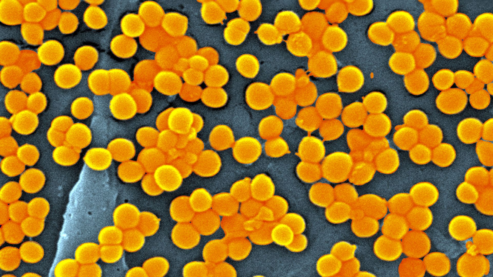 Antibiotic MRSA in a petri dish