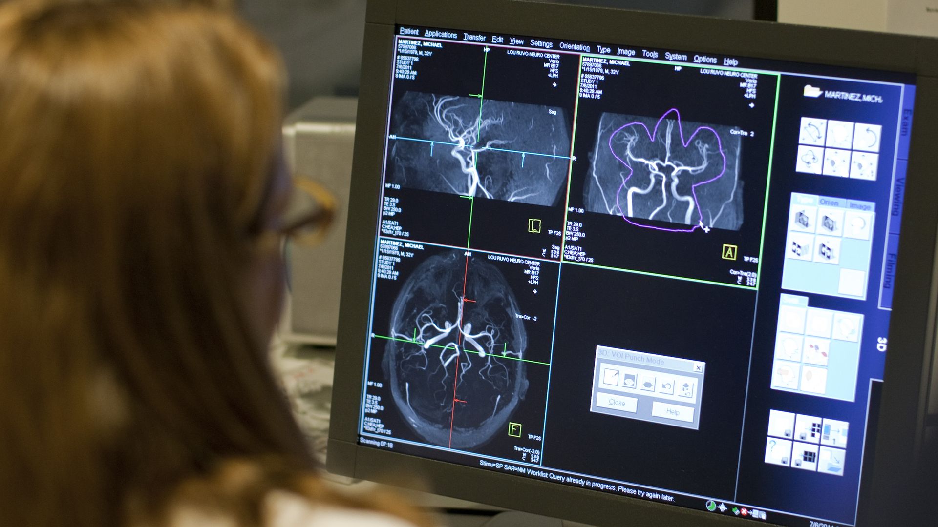 Computer with MRI scans