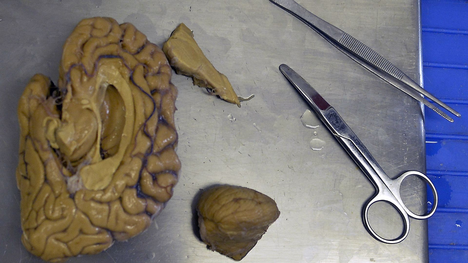 View of a brain section at the laboratory in Medellin, Antioquia department, Colombia.