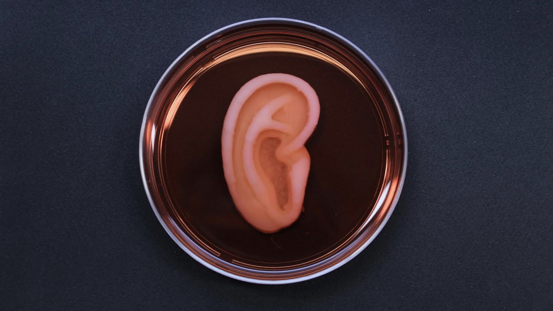 Living ear tissue bioprinted by 3DBio Therapeutics.