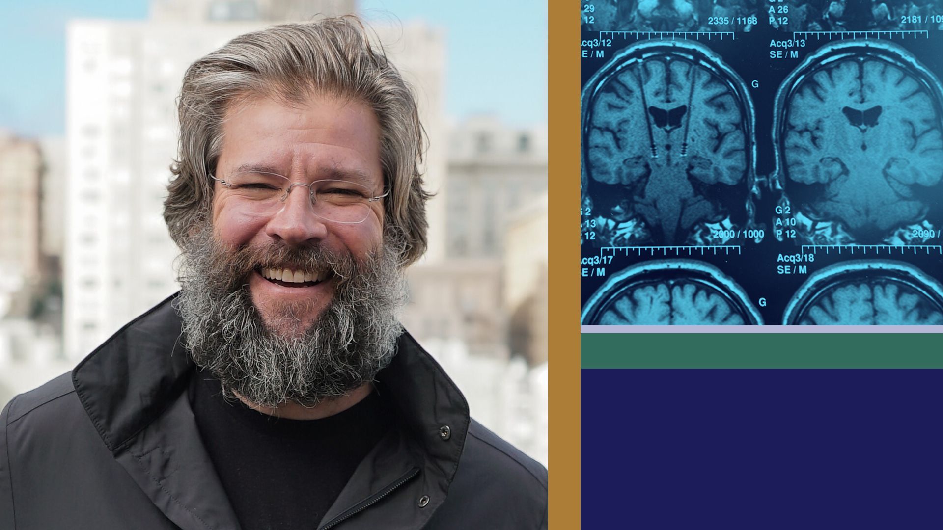 Photo illustration of Vaxxinity Executive Chairman Lou Reese next to an image of MRI of a brain
