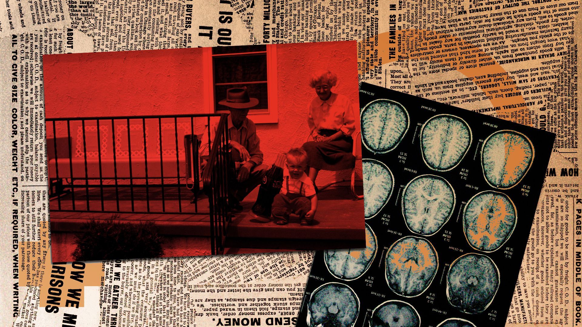 Photo illustration of a photograph of an elderly couple overlaid with an MRI scan of a brain.
