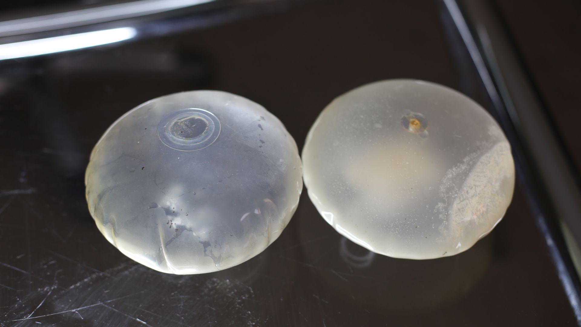 Breast implant device