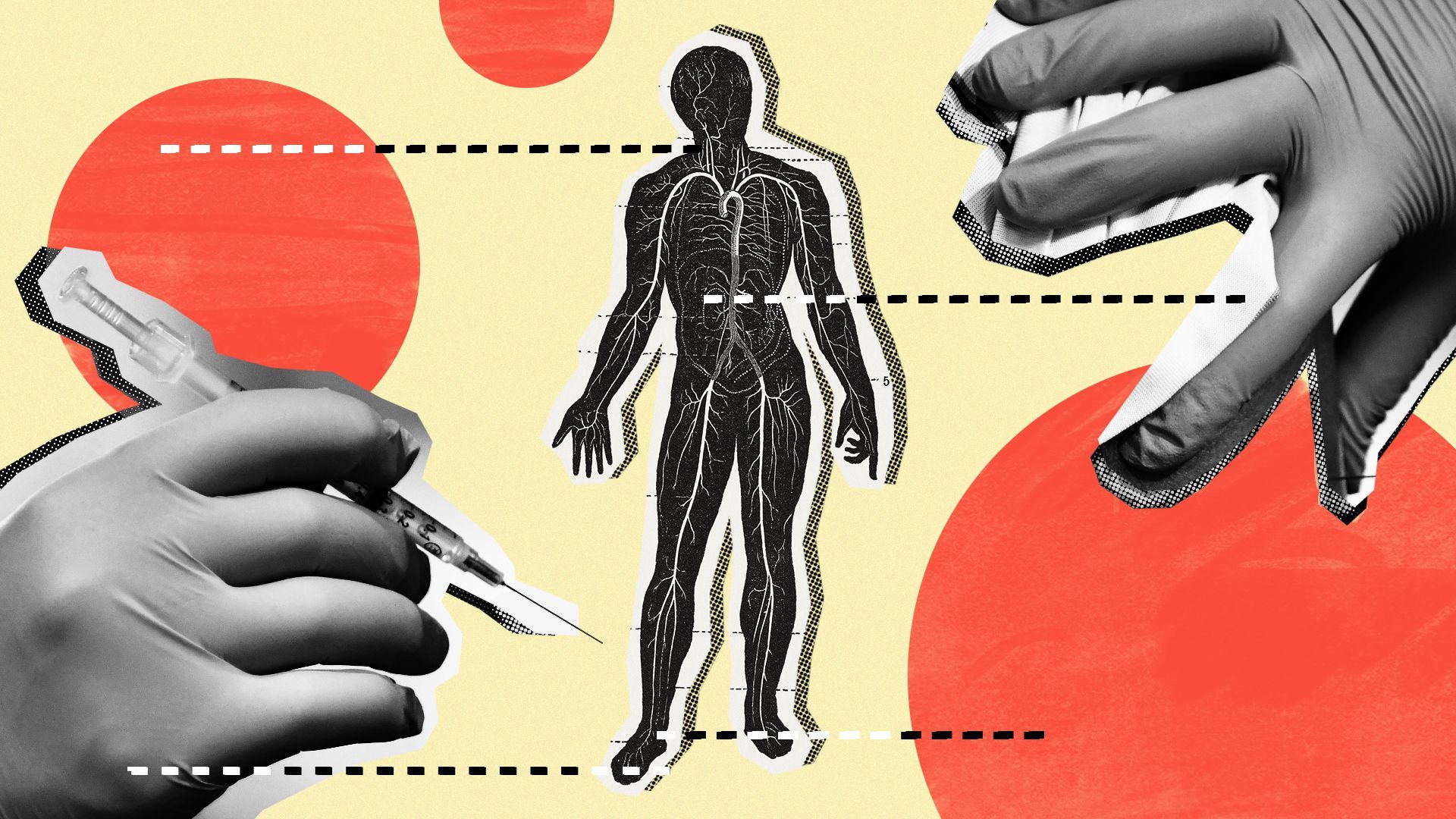  Photo illustration of an anatomical diagram surrounded by health care workers’ hands.