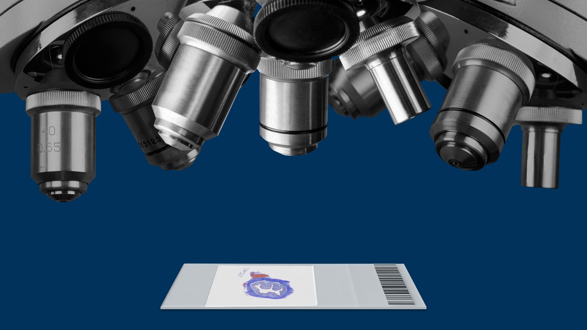 Illustration of multiple microscope lenses examining a microscope slide. 