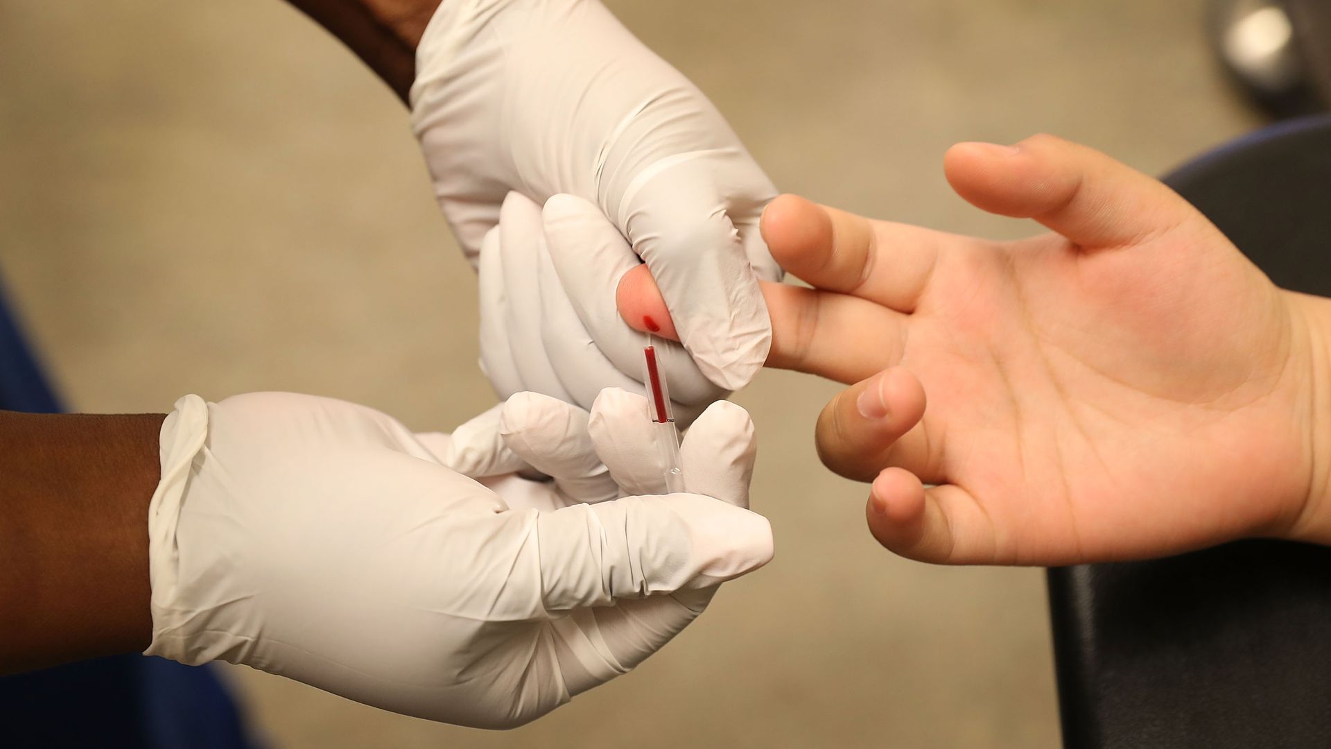 A medical assistant drawing blood from a patient for an HIV test in Miami in June 2017.