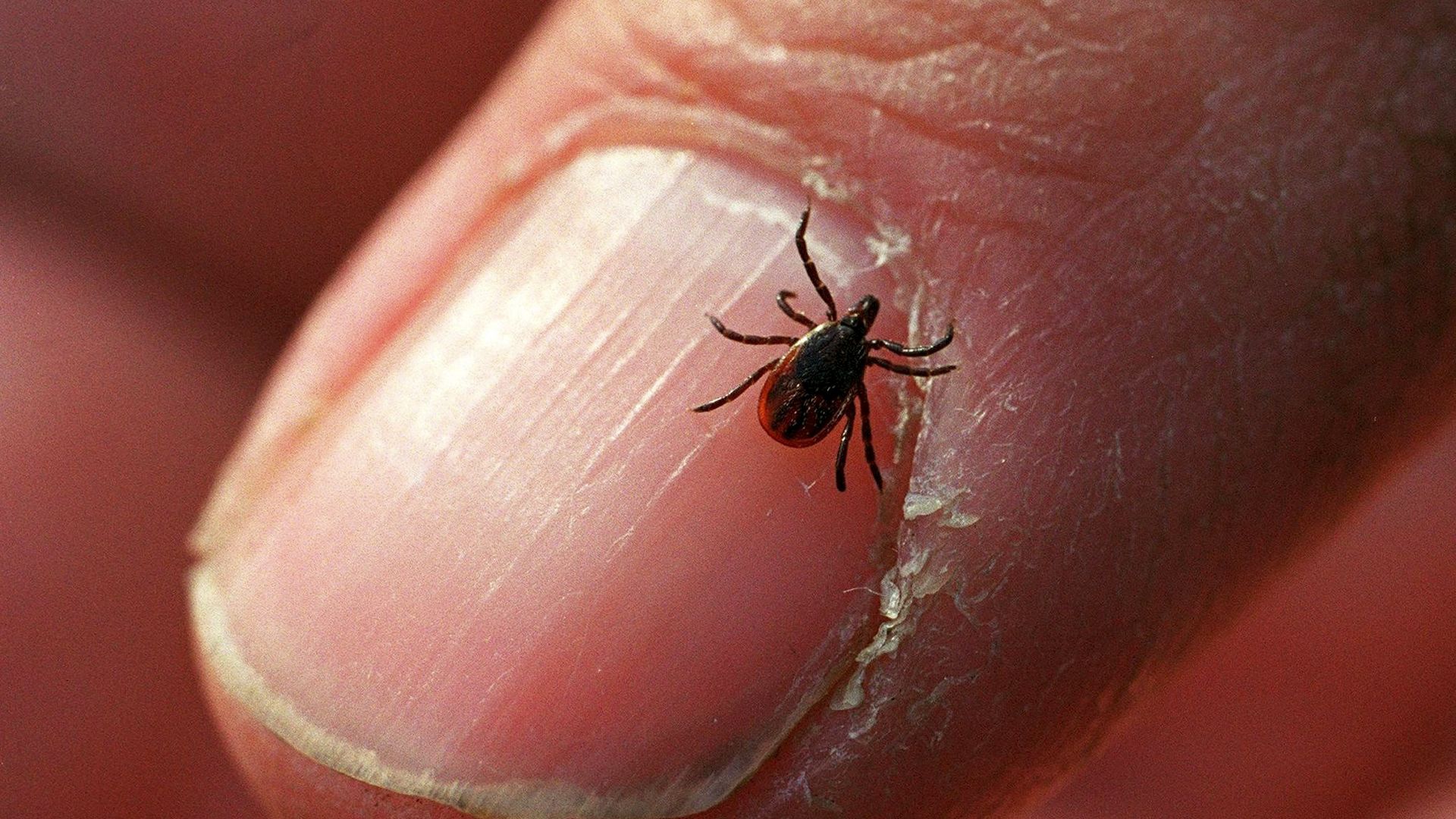 Photo of a tick crawling on a person's thumb