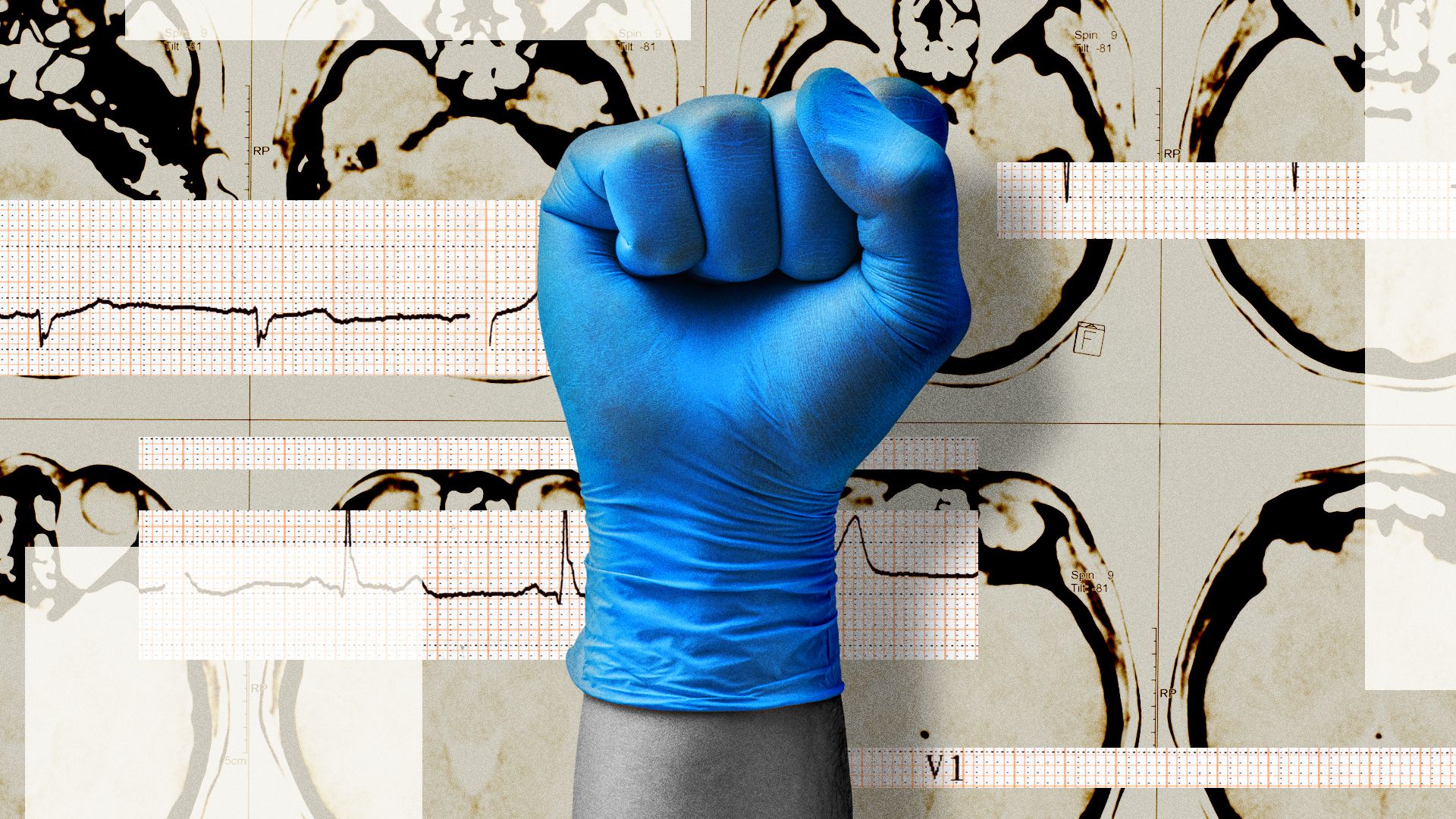 Illustration of a raised fist wearing a blue glove against medical X-rays and EKG lines.
