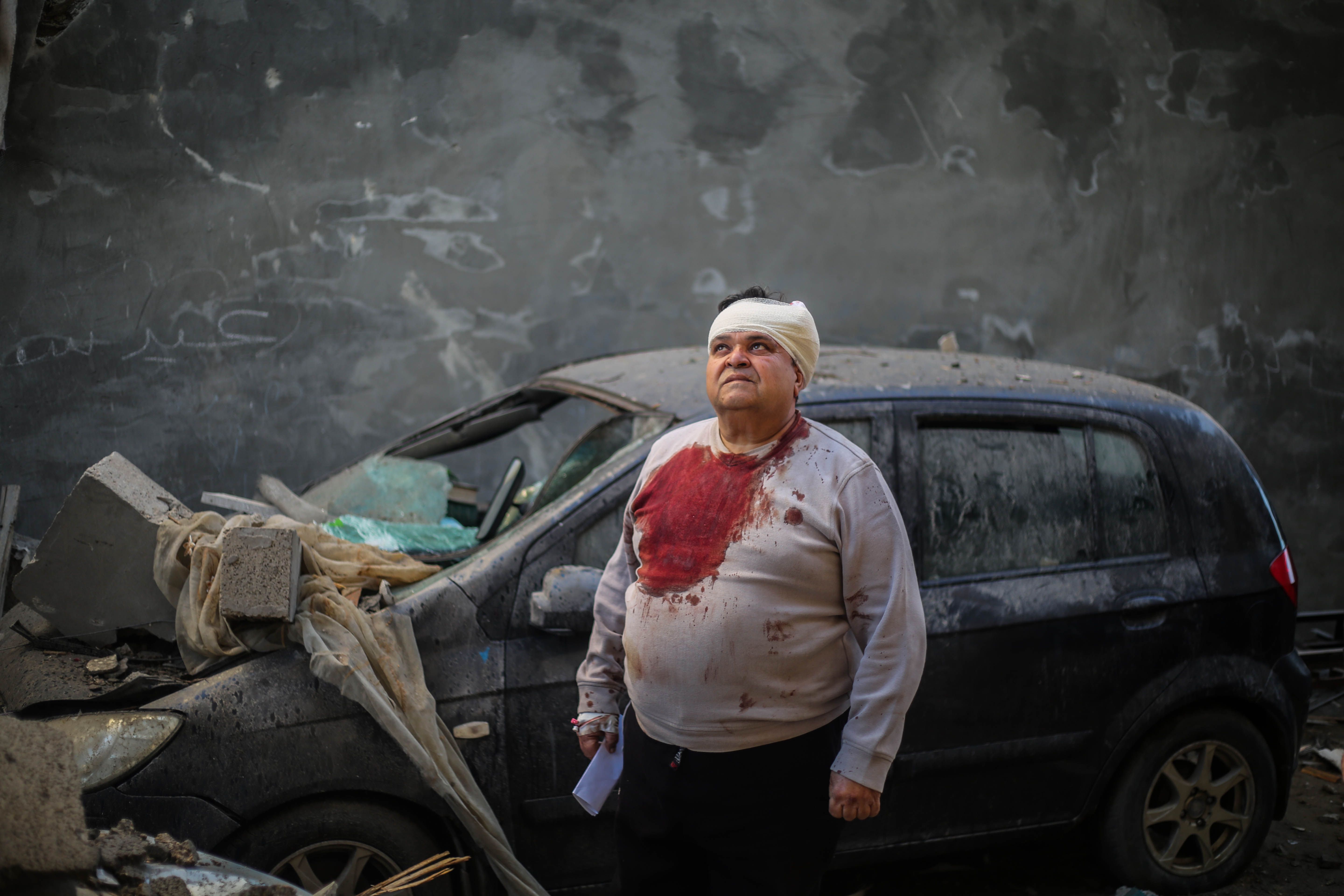 A man wearing a bloodied shirt and bandage on his head looking up at the sky in front of a damaged car. 