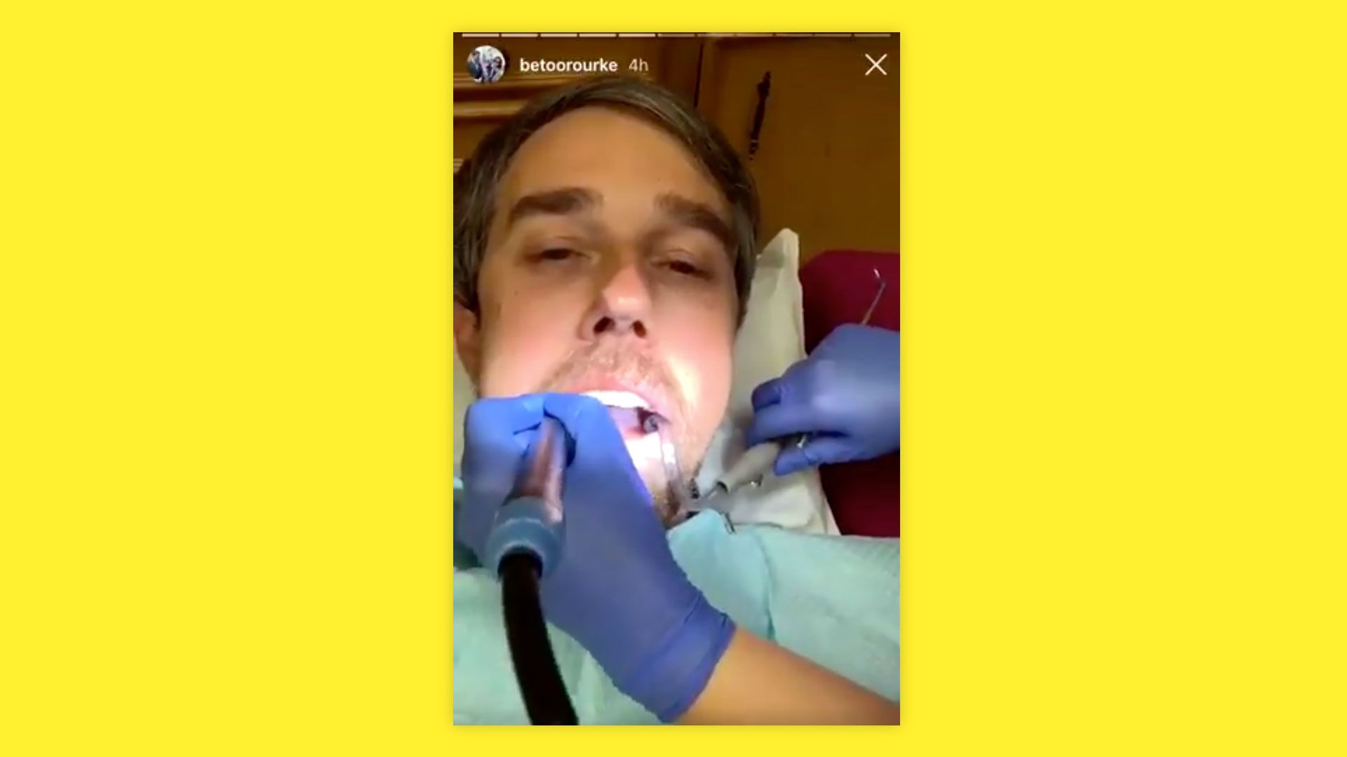 Still from Instagram video of Beto O'Rourke being worked on by dental hygienist