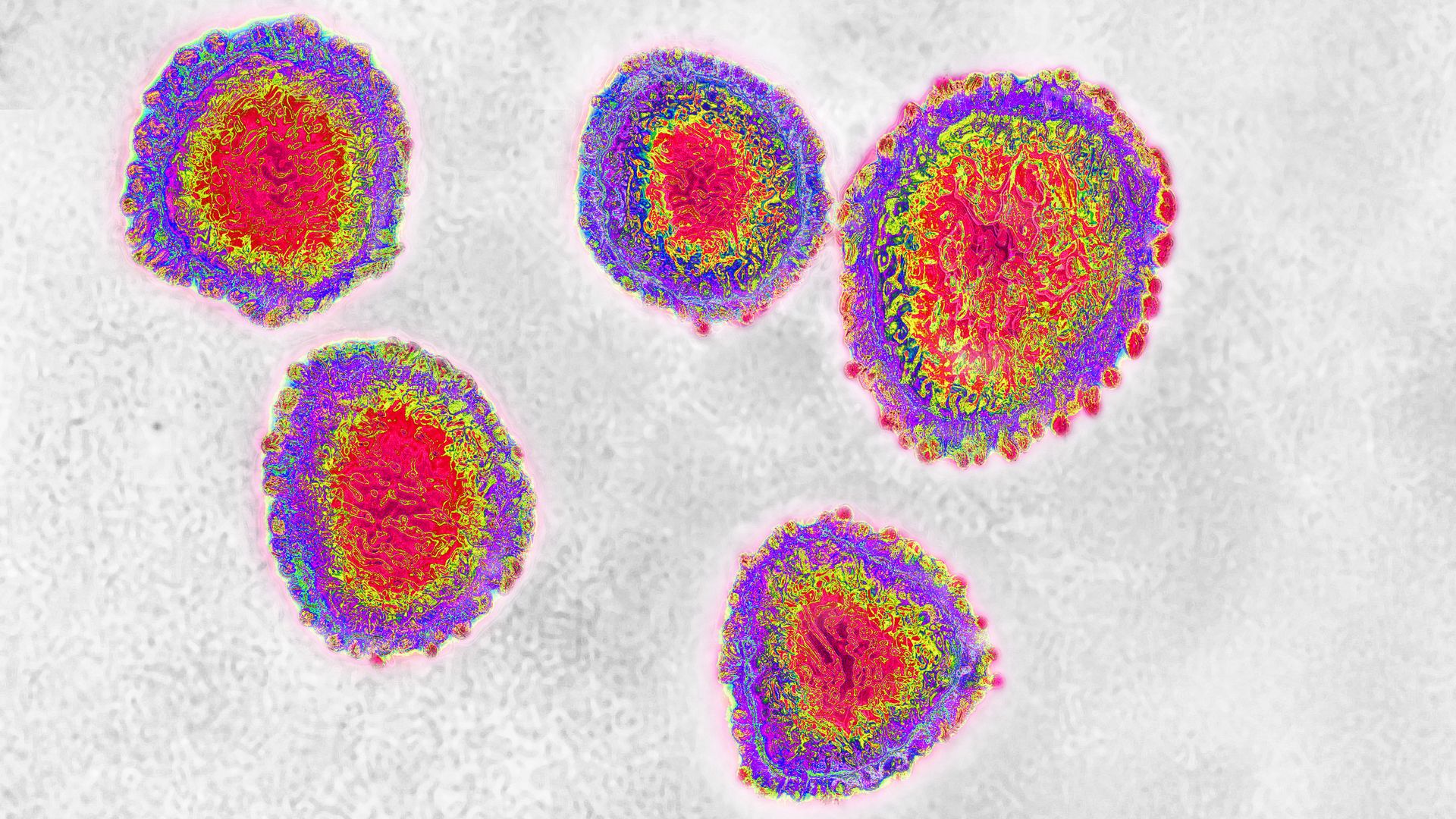 In this image, a group of cells are displayed