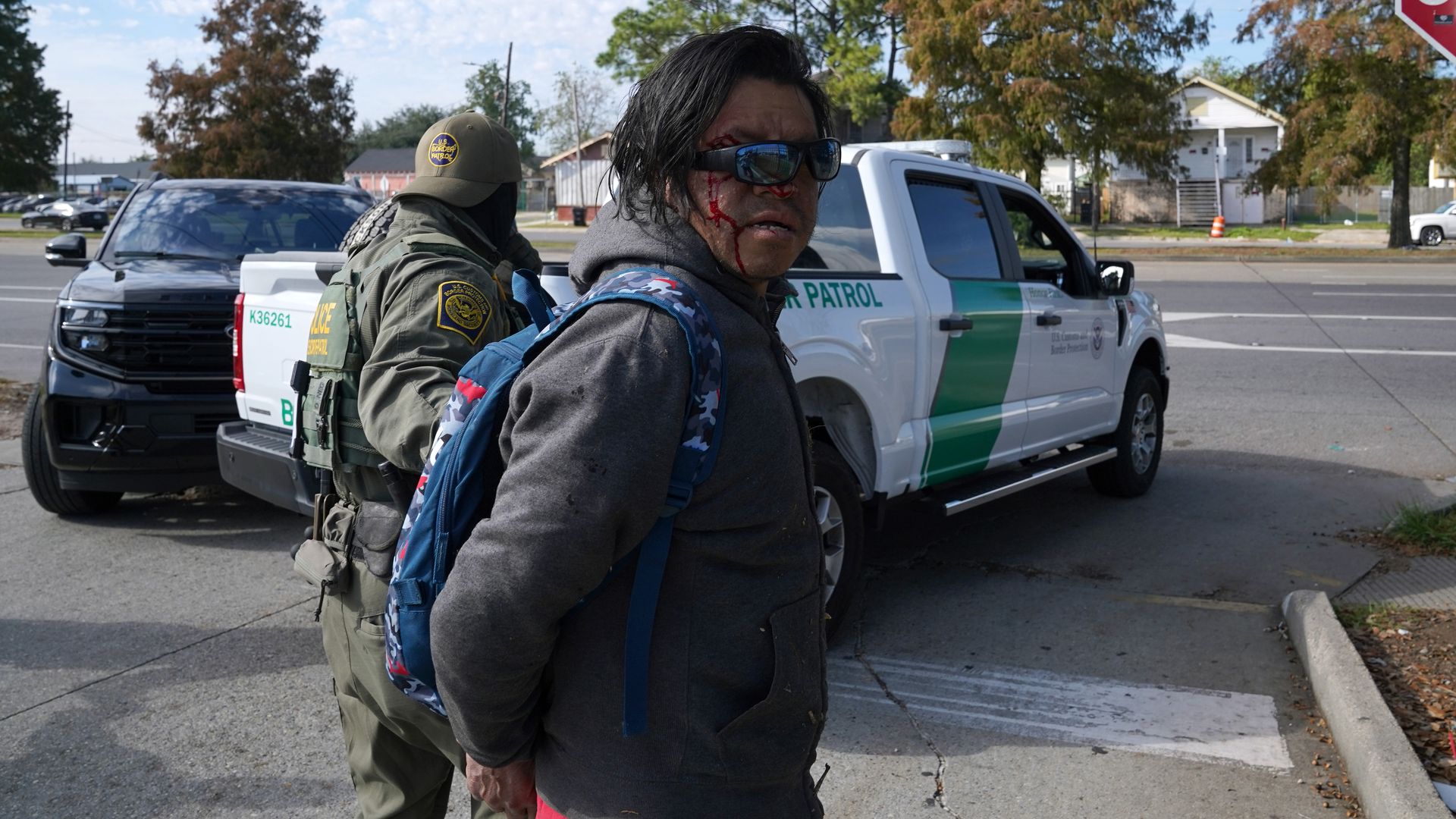 A man looks over his shoulder at the camera as he is pulled by a Border Patrol agent toward a waiting Border Patrol truck. Blood drips down the side of his face and his sunglasses are askew.