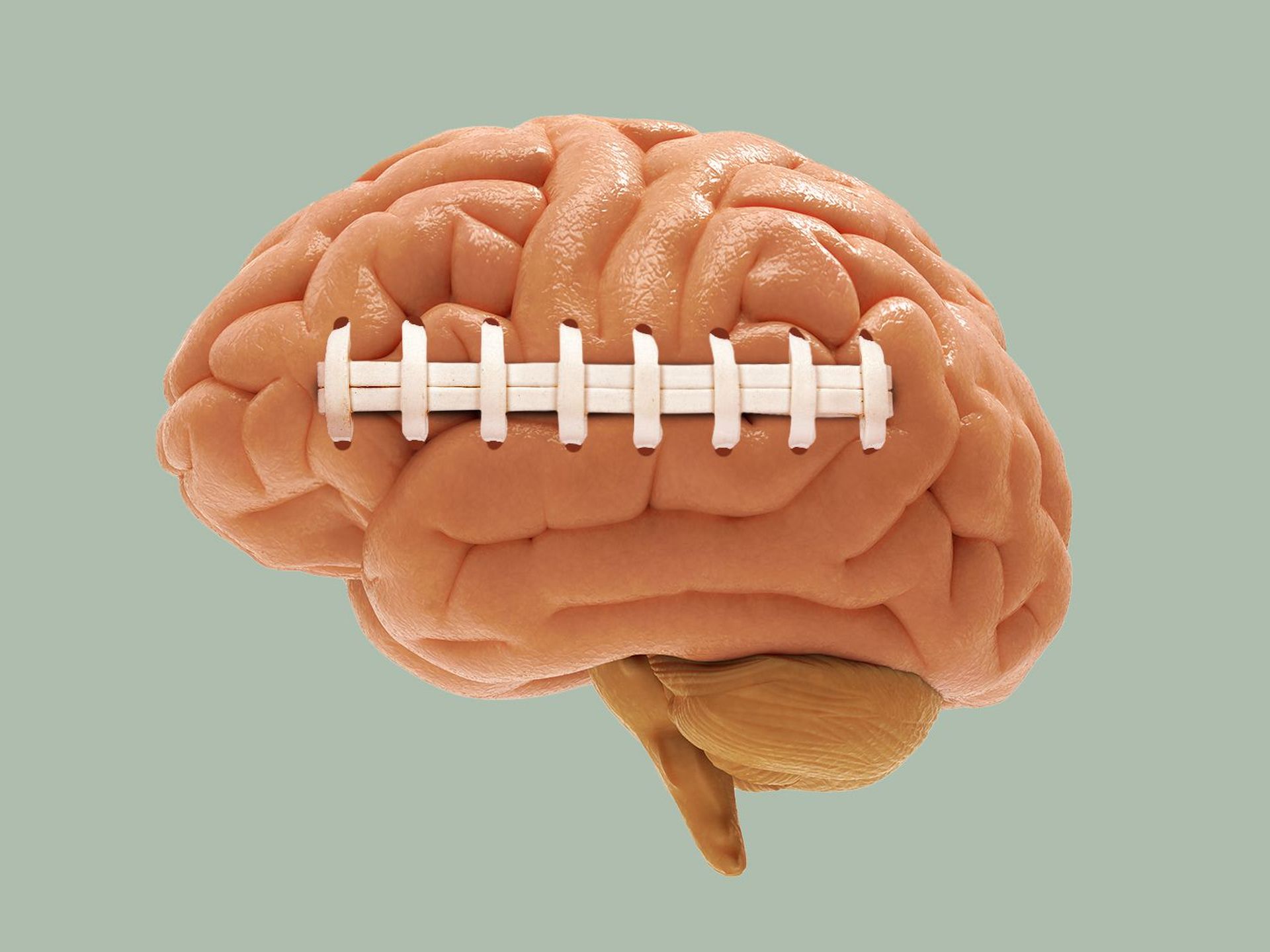 Dig Deeper: Investigating the NFL's Concussion Crisis