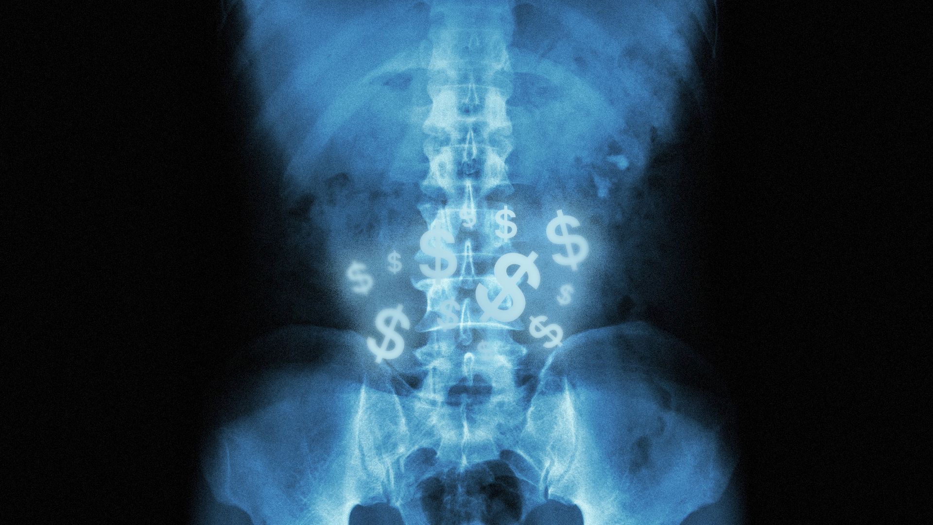 Illustration of an x-ray of a stomach showing dollar bill signs. 