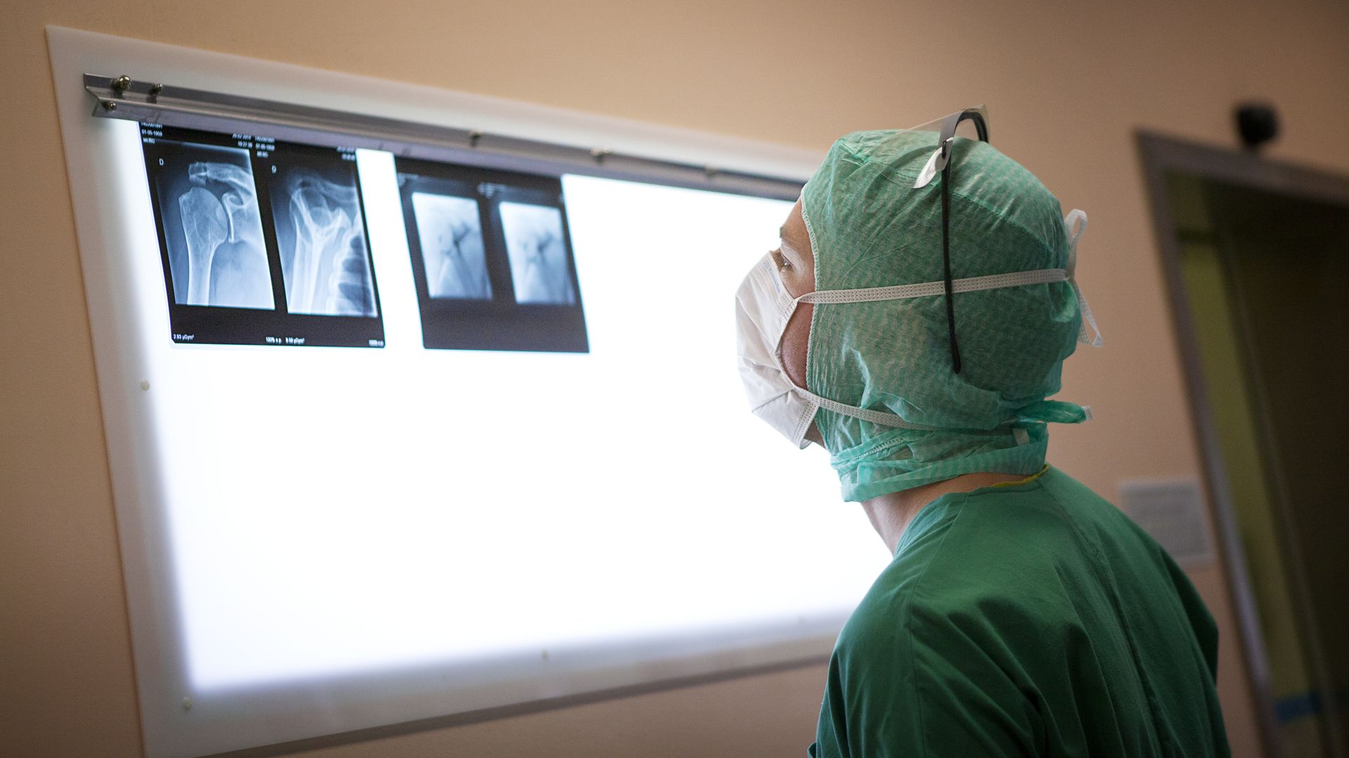 A doctor wearing green scrubs looks at shoulder x-rays mounted on a viewing light.