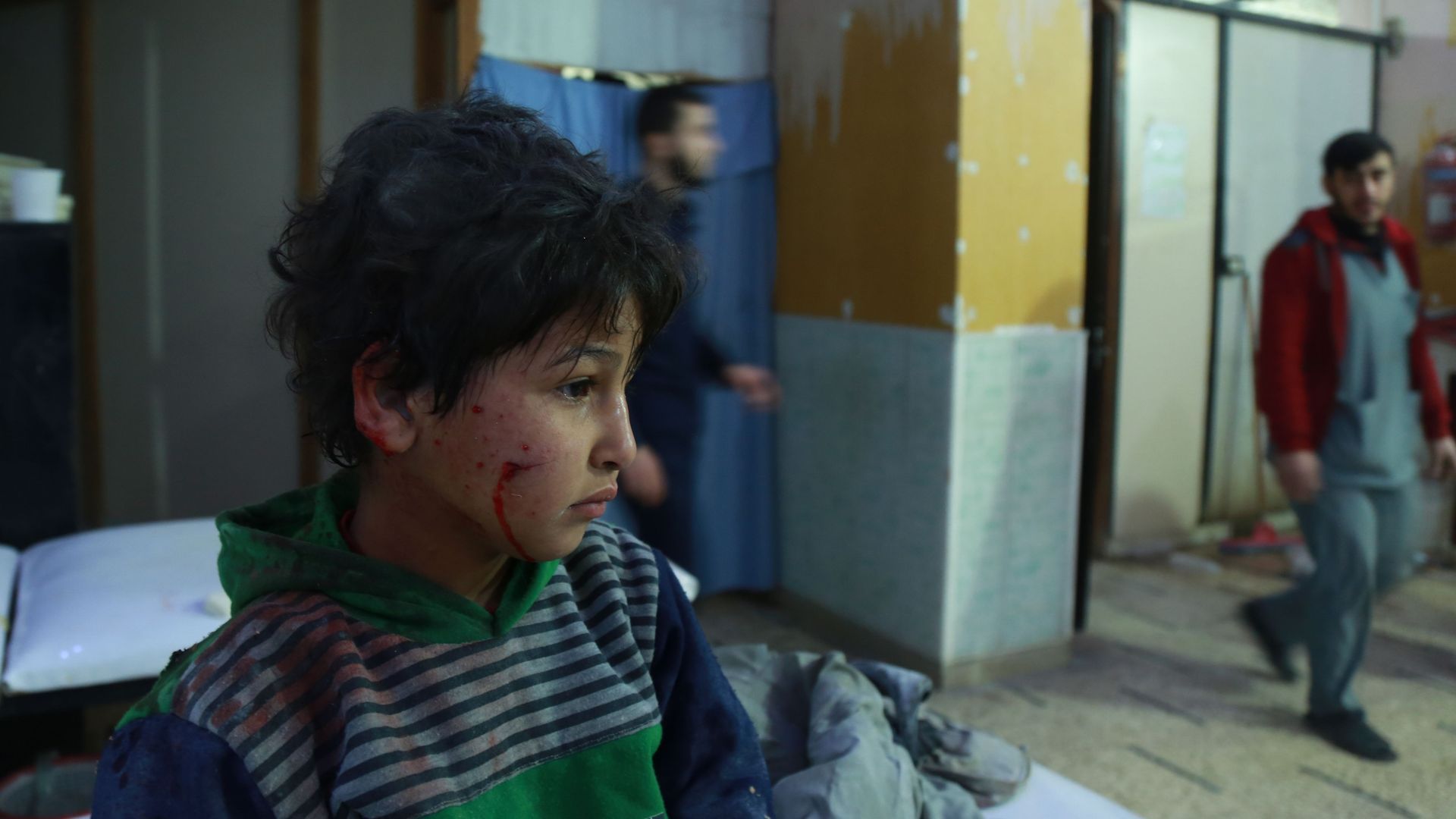 A wounded Syrian child waits for help at a makeshift hospital in the rebel-held town of Douma, in the besieged Eastern Ghouta region.