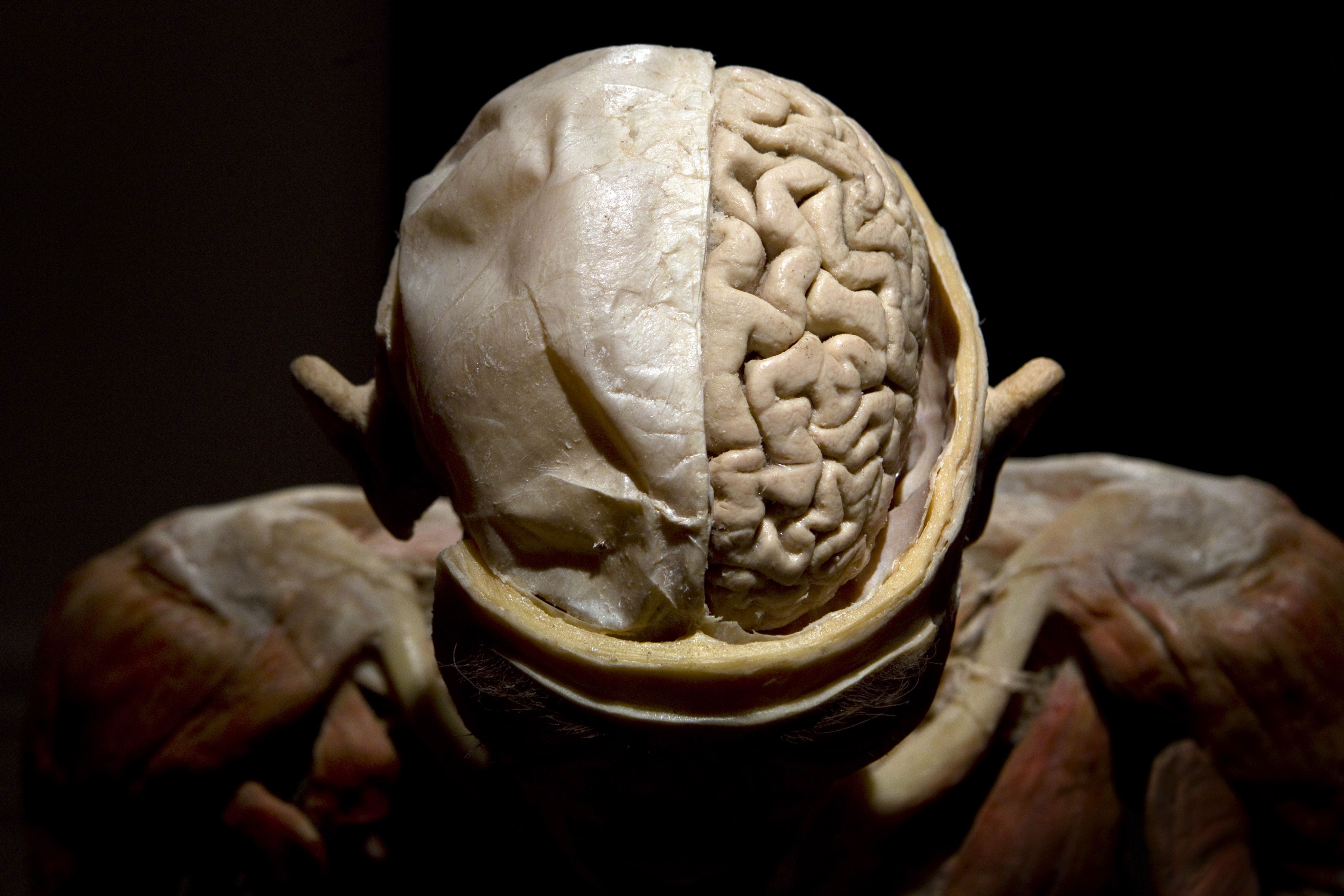 Photo of a fake brain inside a skeleton head.