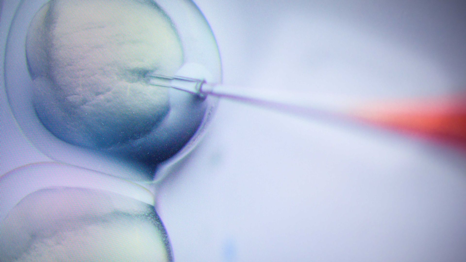 Photo of needle entering a cell as a researcher performs a CRISPR/Cas9 process at the Max-Delbrueck-Centre for Molecular Medicine.