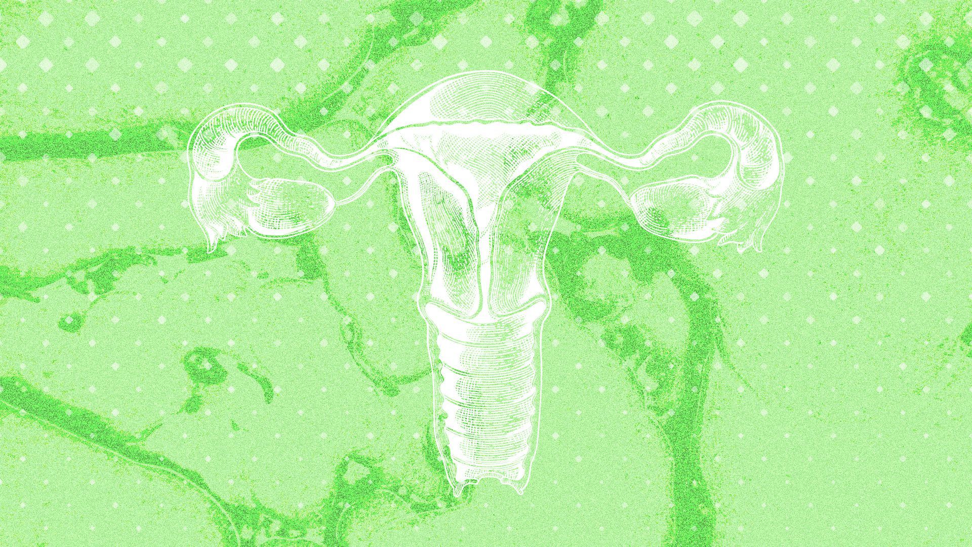Illustration of a medical diagram of a uterus with pills falling all around it. 