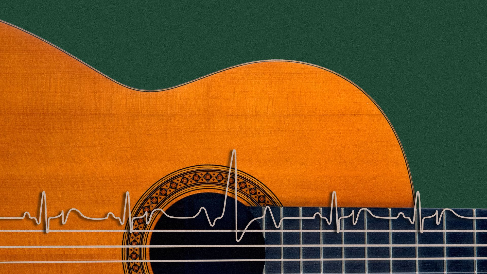 Illustration of an EKG line replacing the string of a guitar.