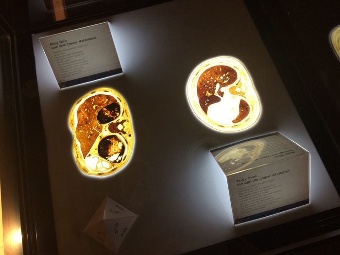 Body Worlds Charlotte