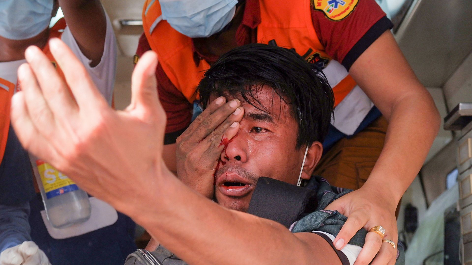 Picture of a protester injured by police in a protest in Myanmar