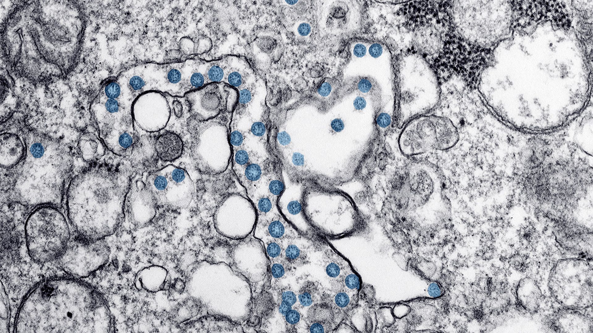 COVID-19-image-cdc coronavirus