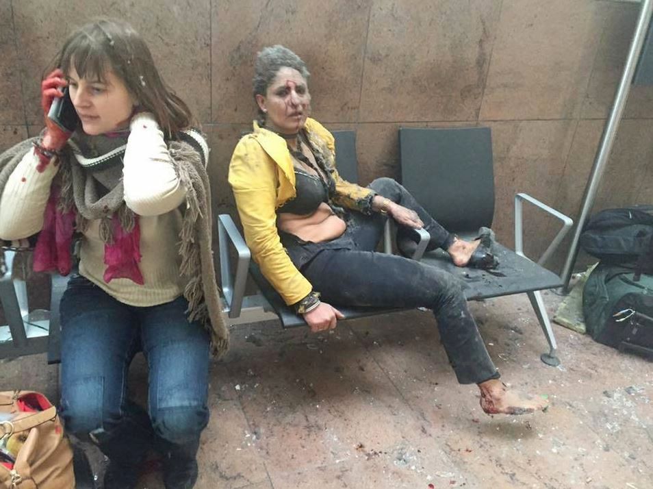  An injured woman looks on as another speaks on her mobile phone following twin blasts at Brussels airport in Zaventem on March 22, 2016 