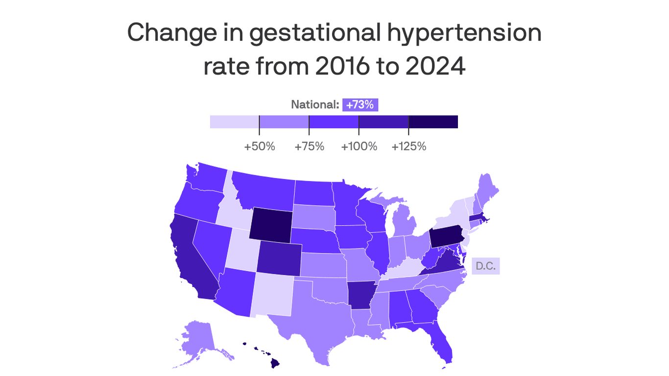 Mapped: High blood pressure during pregnancy is rising in Minnesota
