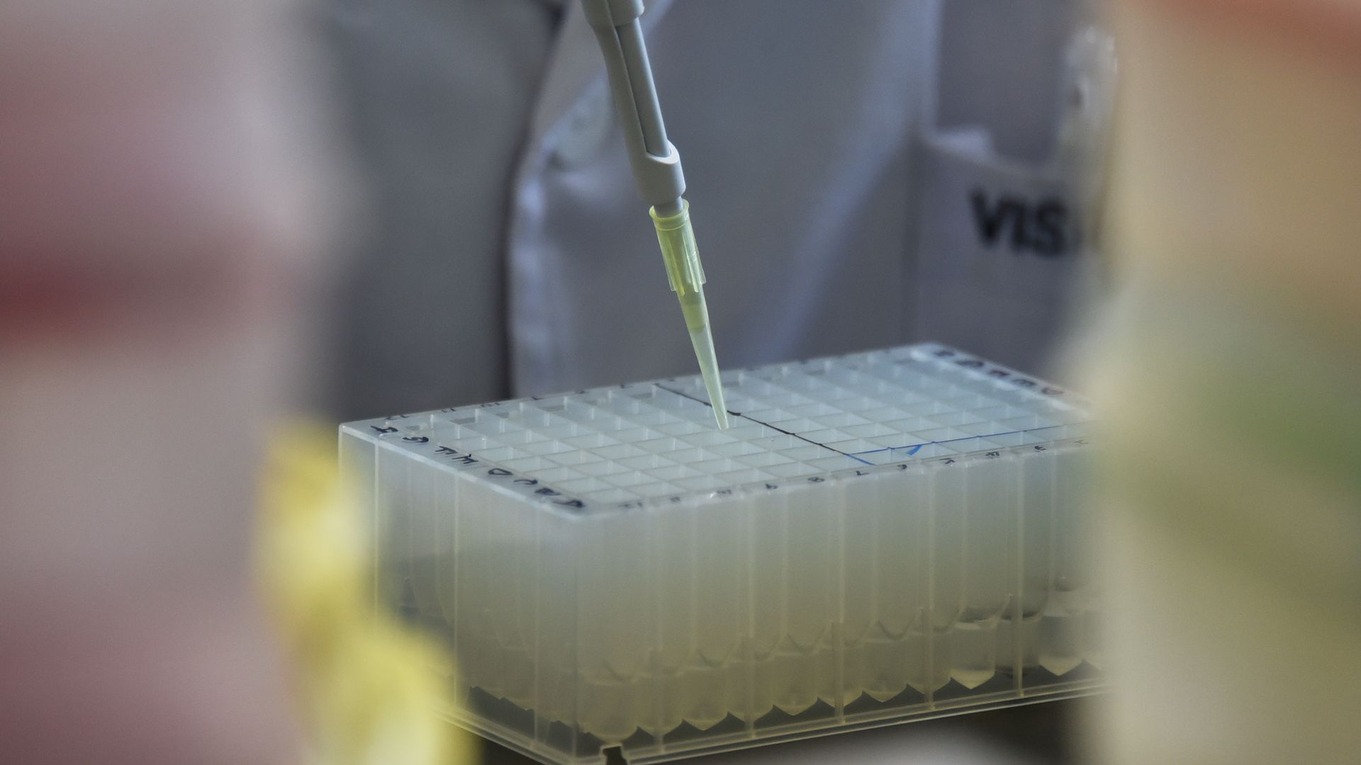 DNA sequencing