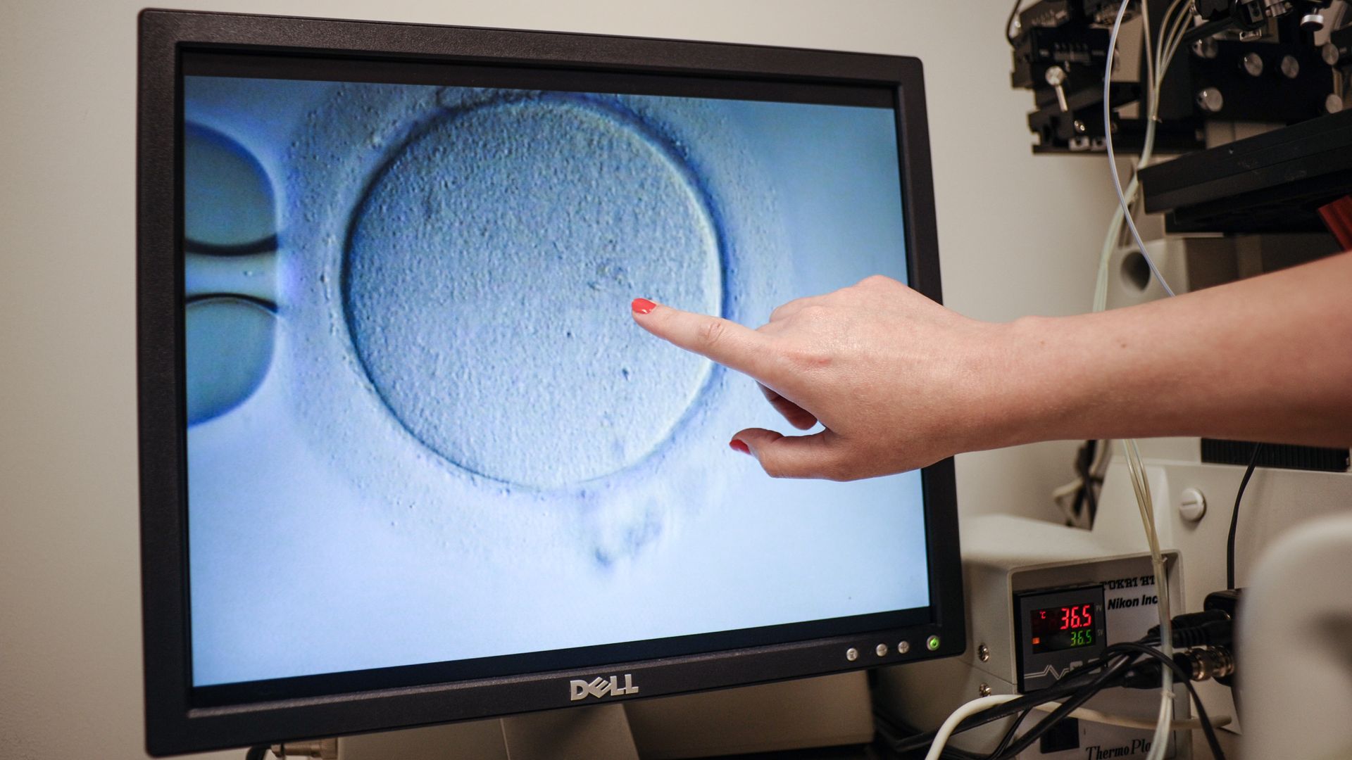 A finger pointing at a computer screen with an embryo on it. 
