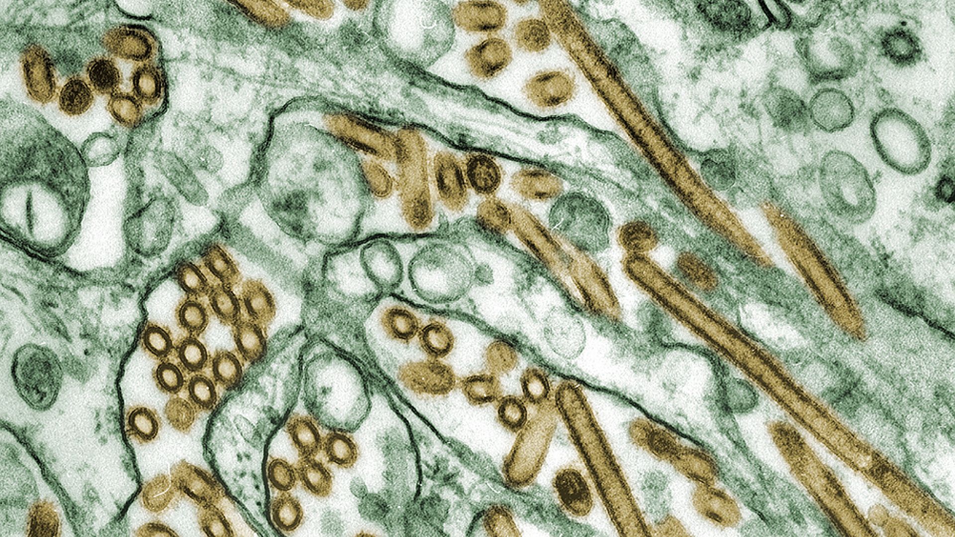 A colorized electron micrograph of H5N1 viruses