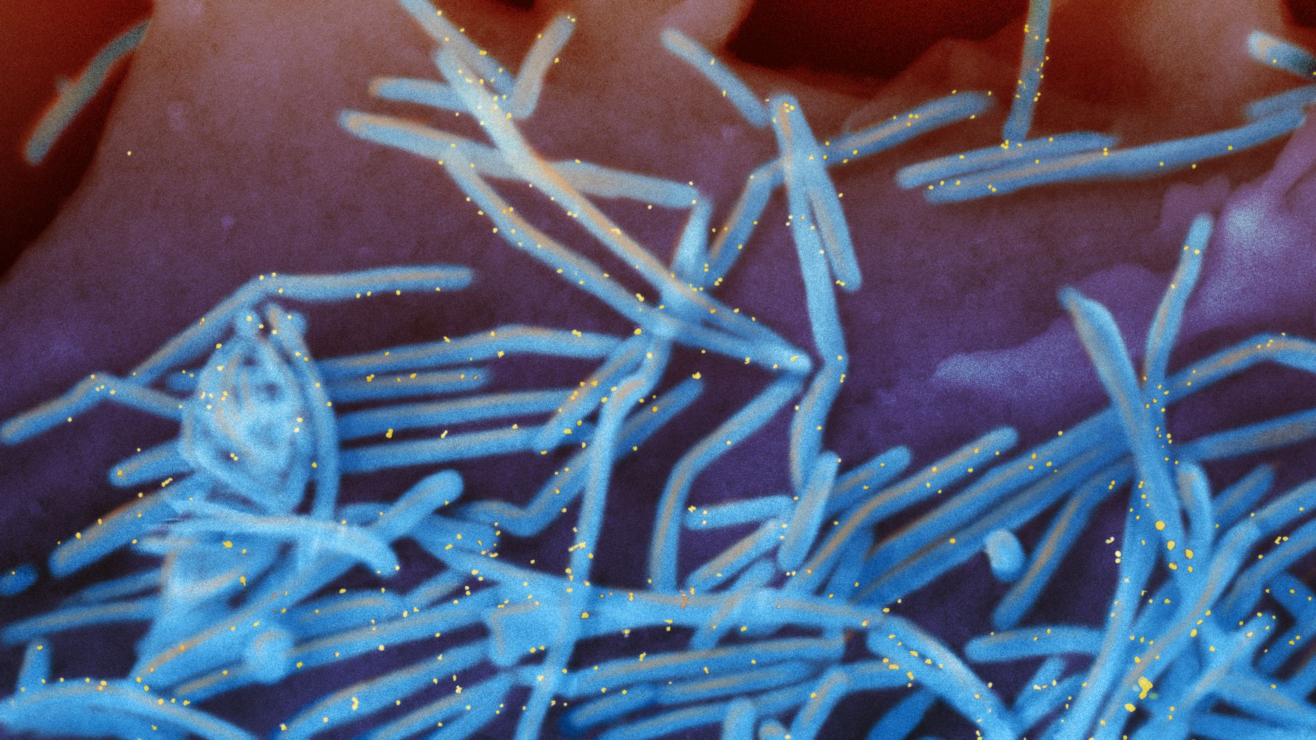 Scanning electron micrograph of human respiratory syncytial virus (RSV) virions (colorized blue) and labeled with anti-RSV F protein/gold antibodies (colorized yellow